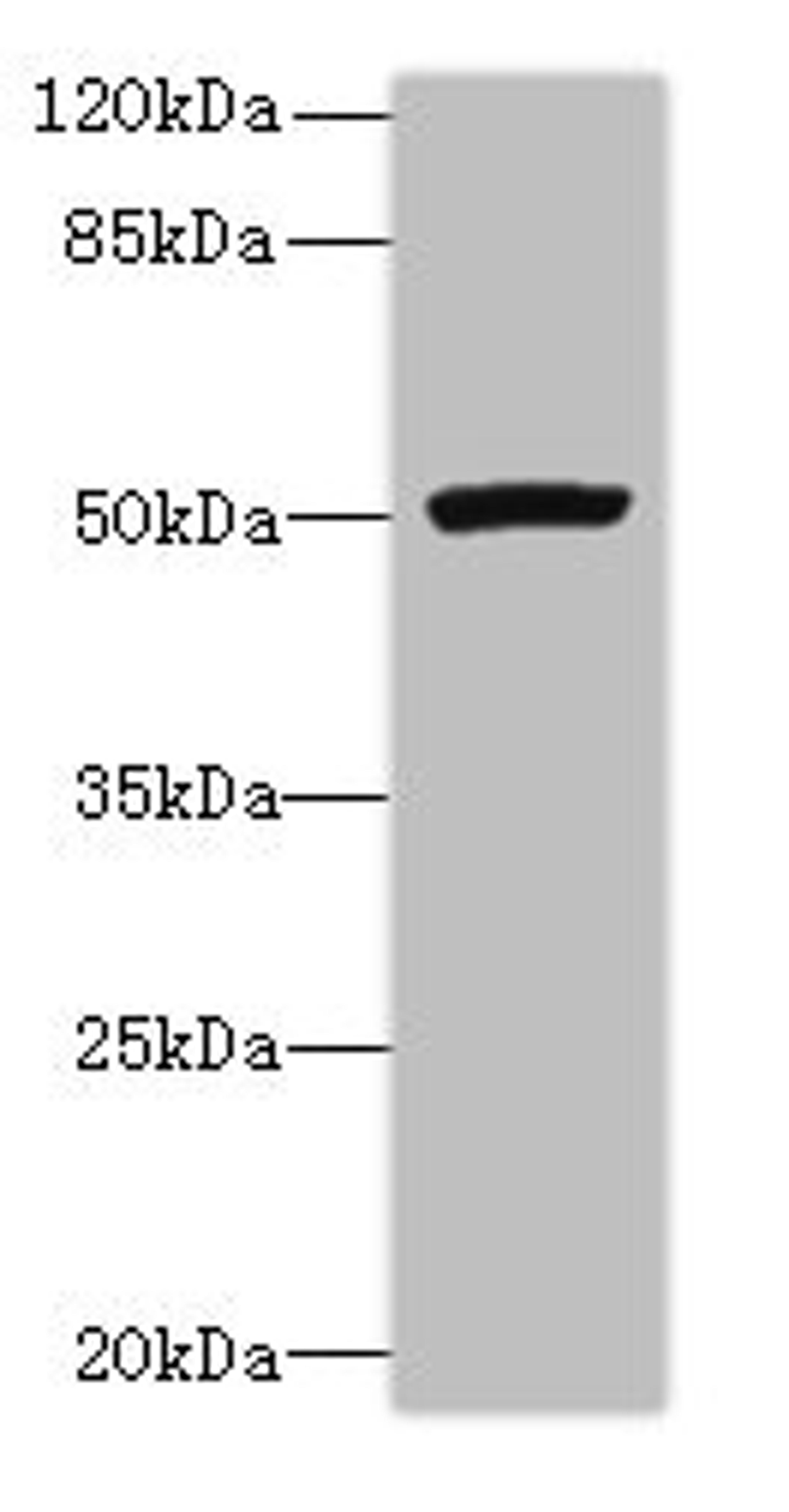 Western blot. All lanes: PORCN antibody at 3µg/ml + Mouse thymus tissue. Secondary. Goat polyclonal to rabbit IgG at 1/10000 dilution. Predicted band size: 53, 52, 43 kDa. Observed band size: 53 kDa