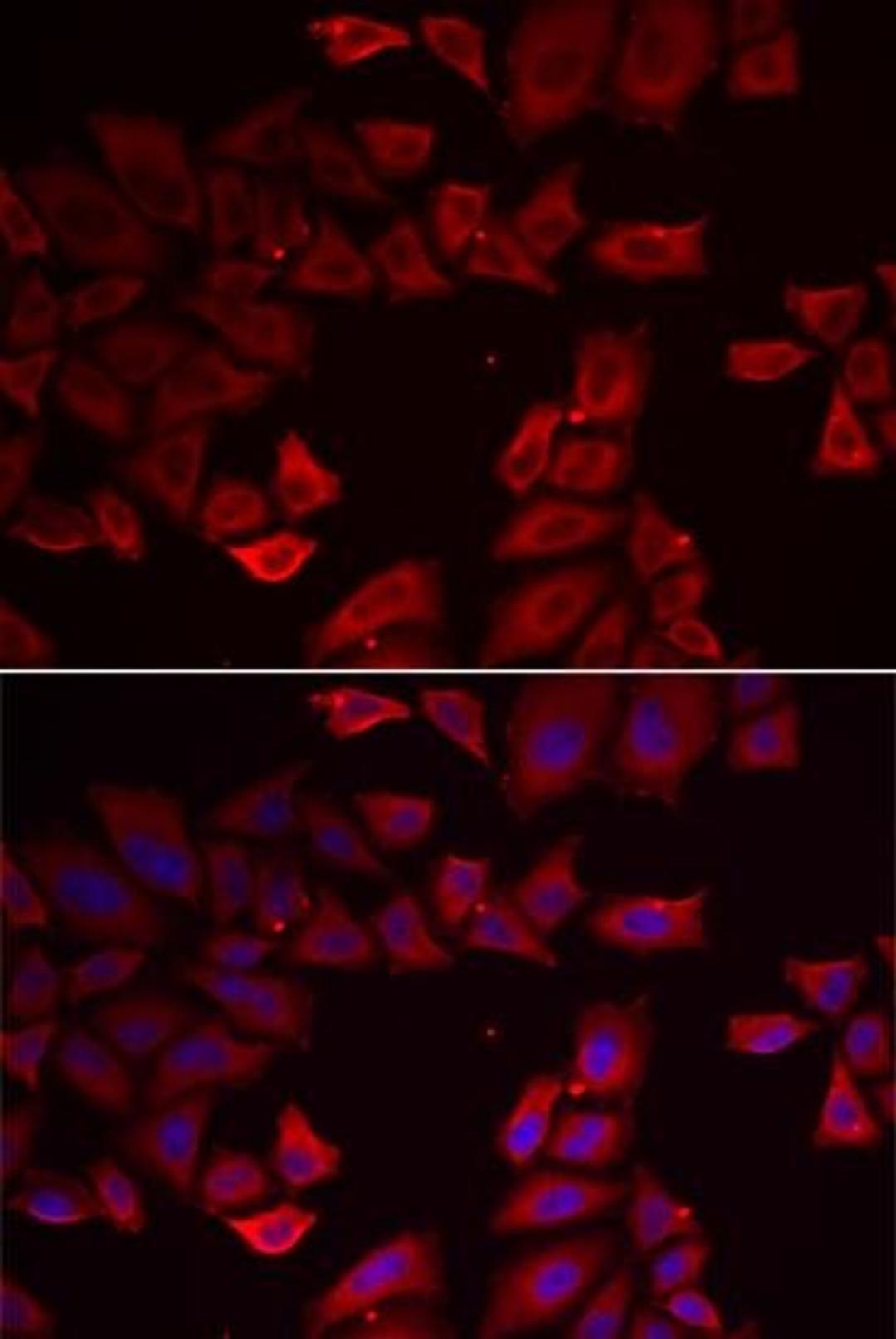 Immunofluorescense analysis of HeLa cell using SEPHS1 antibody