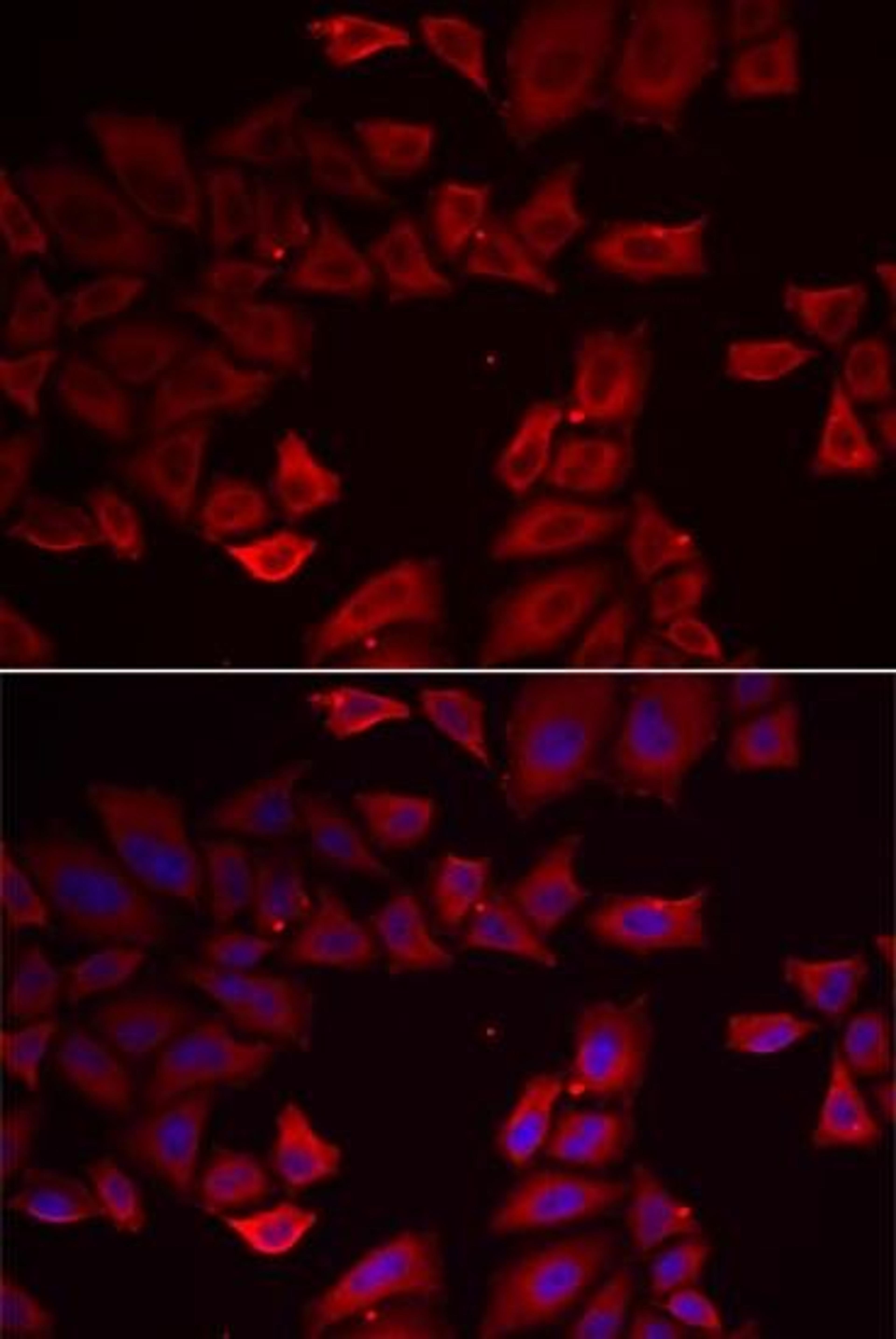 Immunofluorescense analysis of HeLa cell using SEPHS1 antibody