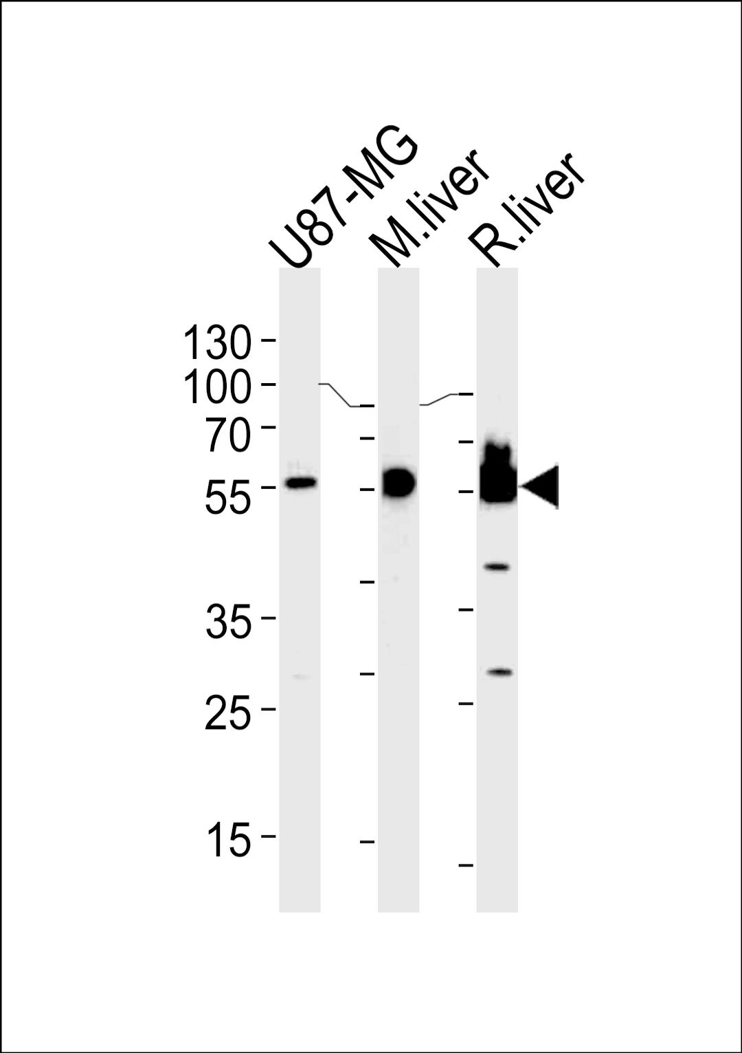 Western blot analysis in U87-MG cell line,mouse liver and rat liver lysates (35ug/lane).