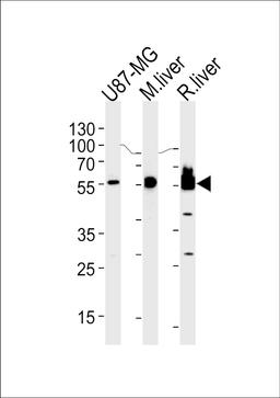 Western blot analysis in U87-MG cell line,mouse liver and rat liver lysates (35ug/lane).
