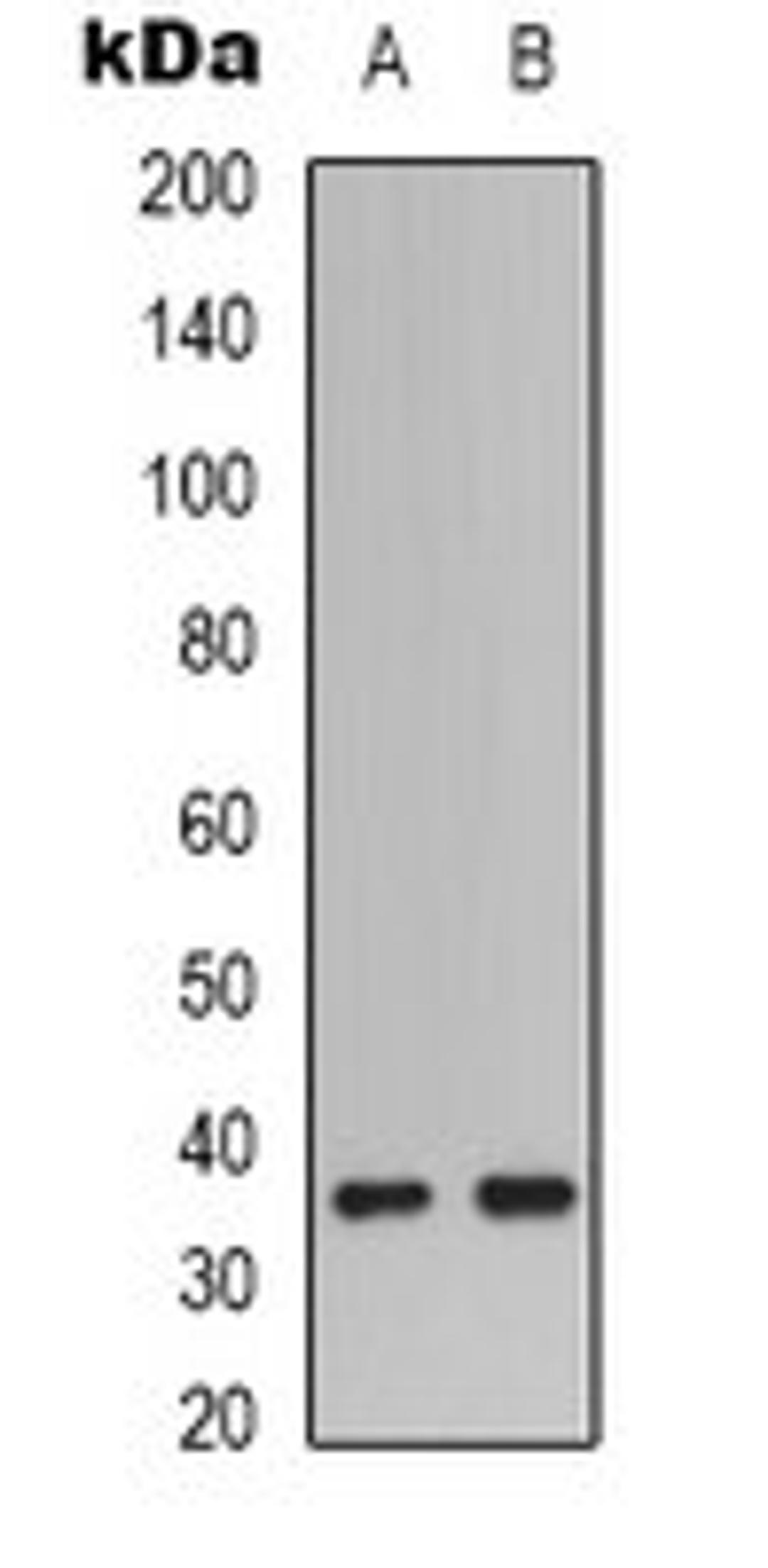 Western blot analysis of A549 (Lane 1), HEK293T (Lane 2) whole cell lysates using Caspase 9 p35 antibody