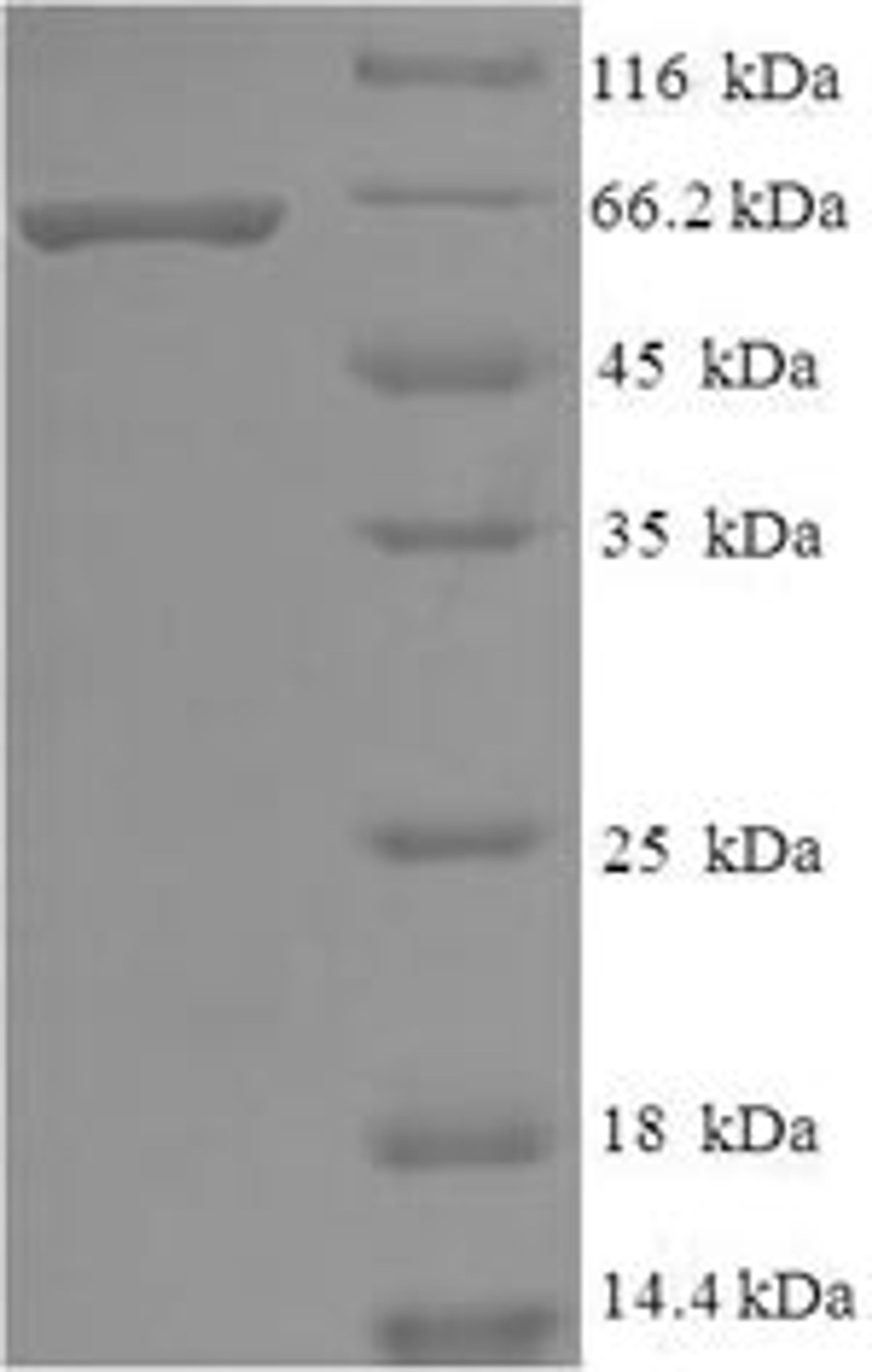 (Tris-Glycine gel) Discontinuous SDS-PAGE (reduced) with 5% enrichment gel and 15% separation gel.