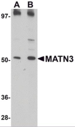 Western blot analysis of MATN3 in 3T3 cell lysate with MATN3 antibody at (A) 1 and (B) 2 &#956;g/mL.