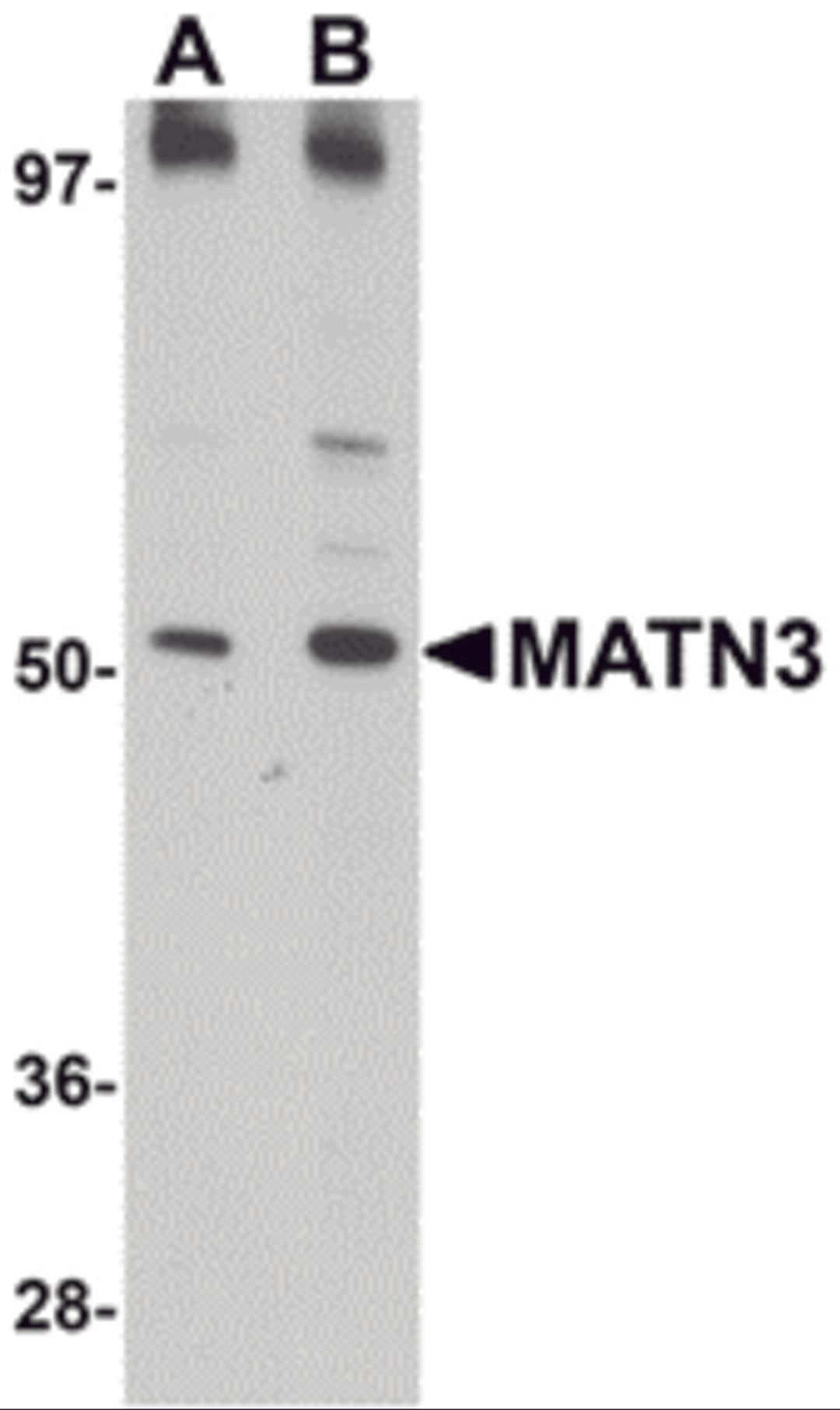 Western blot analysis of MATN3 in 3T3 cell lysate with MATN3 antibody at (A) 1 and (B) 2 μg/mL.