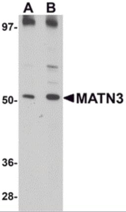 Western blot analysis of MATN3 in 3T3 cell lysate with MATN3 antibody at (A) 1 and (B) 2 μg/mL.