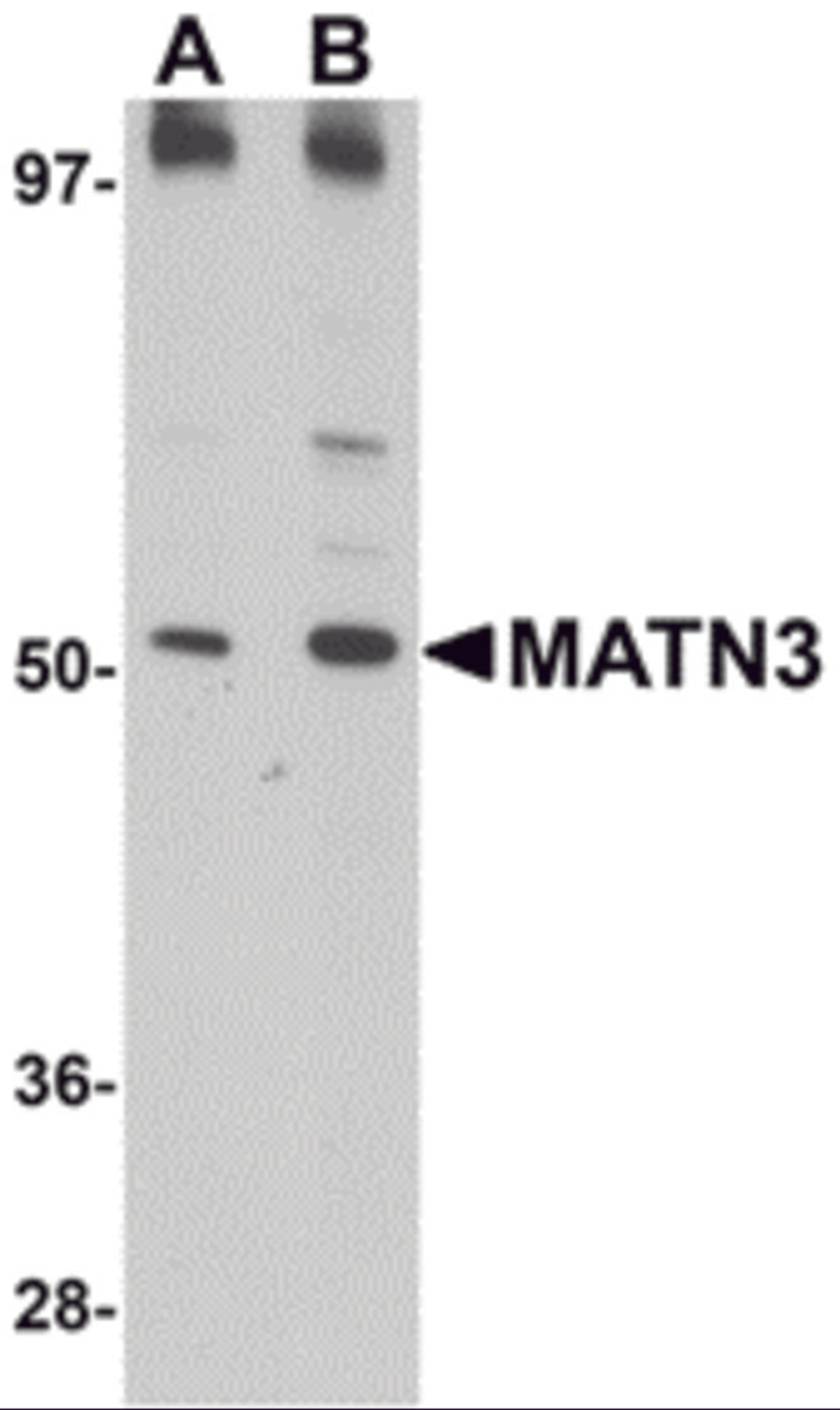 Western blot analysis of MATN3 in 3T3 cell lysate with MATN3 antibody at (A) 1 and (B) 2 μg/mL.