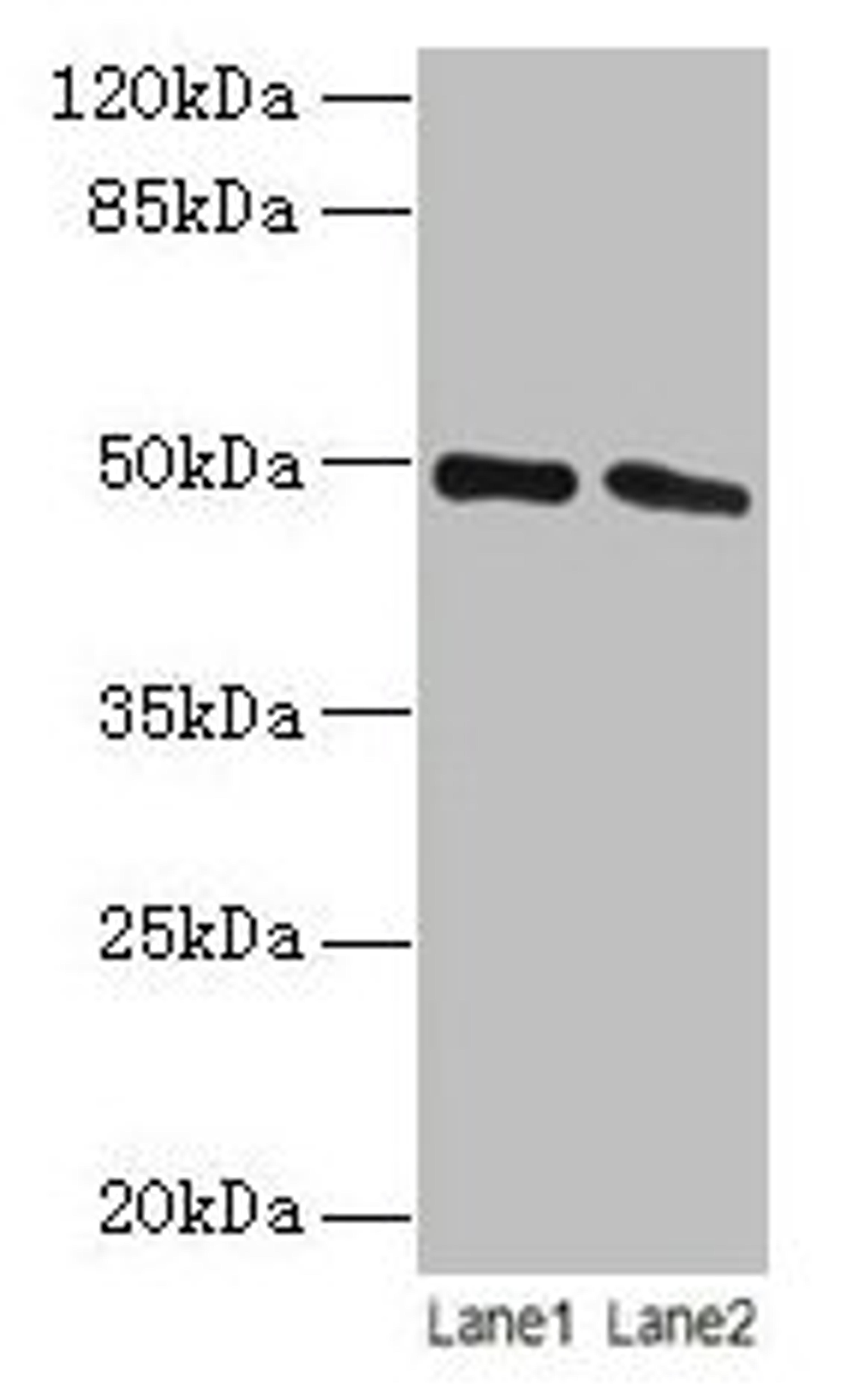 Western blot. All lanes: STAMBP antibody at 12µg/ml. Lane 1: Jurkat whole cell lysate. Lane 2: Hela whole cell lysate. Secondary. Goat polyclonal to rabbit IgG at 1/10000 dilution. Predicted band size: 49, 40 kDa. Observed band size: 49 kDa