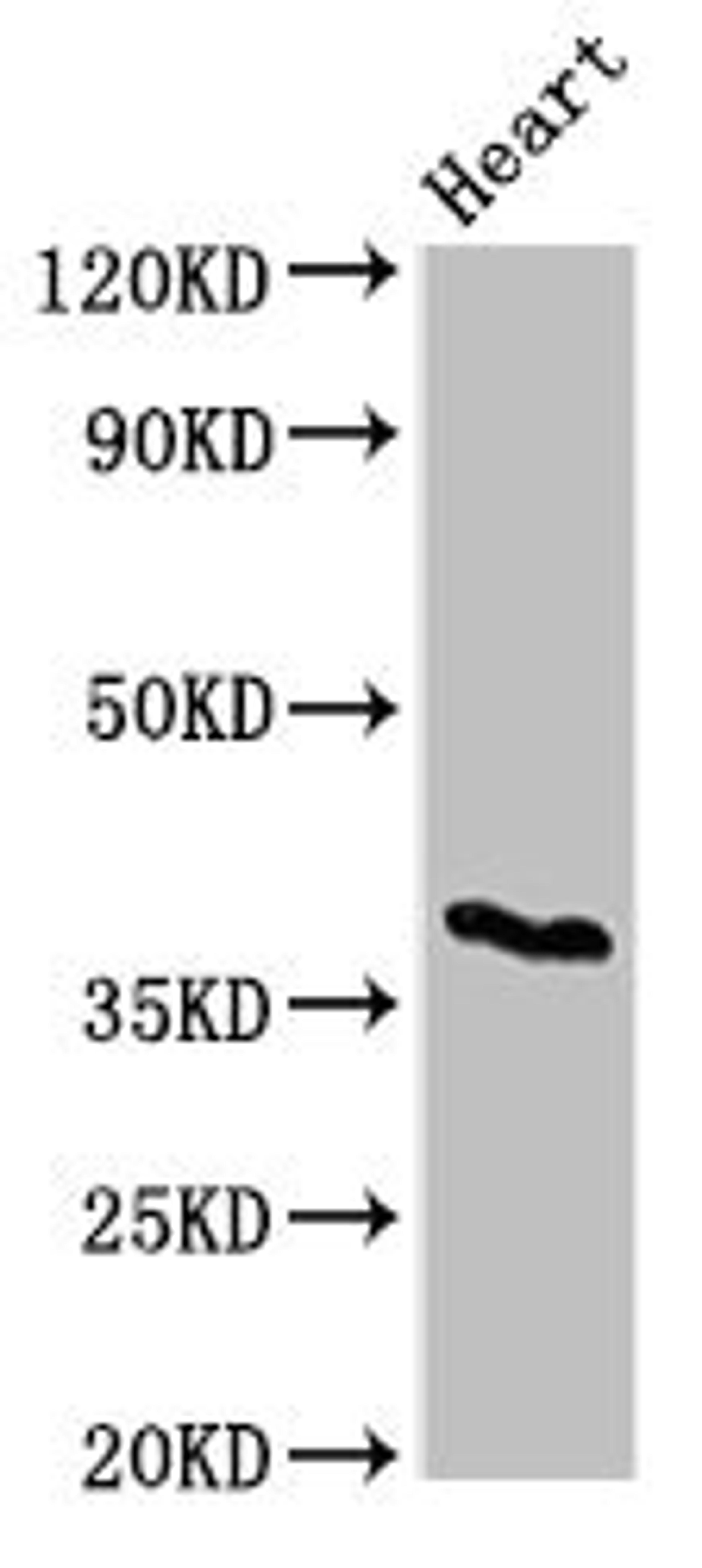 Western Blot. Positive WB detected in: Mouse heart tissue. All lanes: CD1C antibody at 3ug/ml. Secondary. Goat polyclonal to rabbit IgG at 1/50000 dilution. Predicted band size: 38 kDa. Observed band size: 38 kDa. 