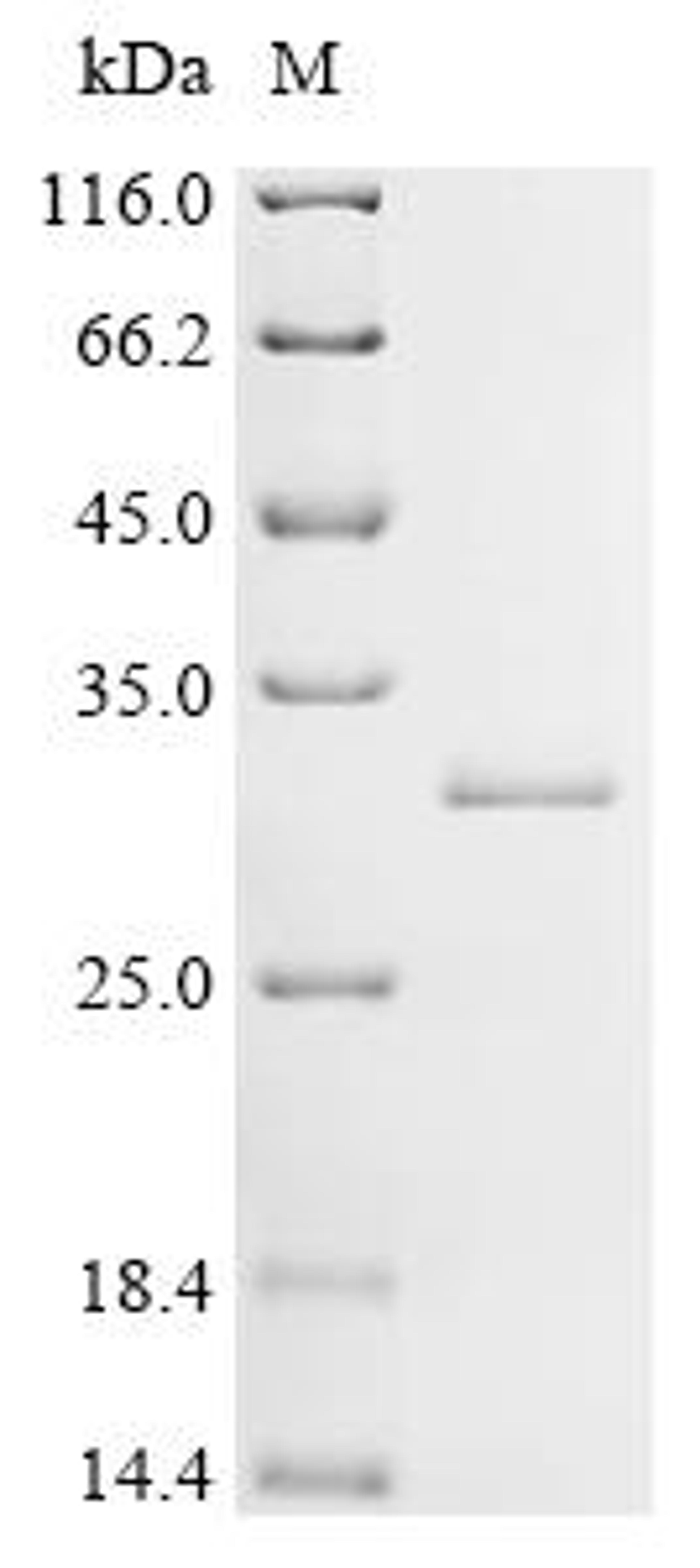 (Tris-Glycine gel) Discontinuous SDS-PAGE (reduced) with 5% enrichment gel and 15% separation gel.