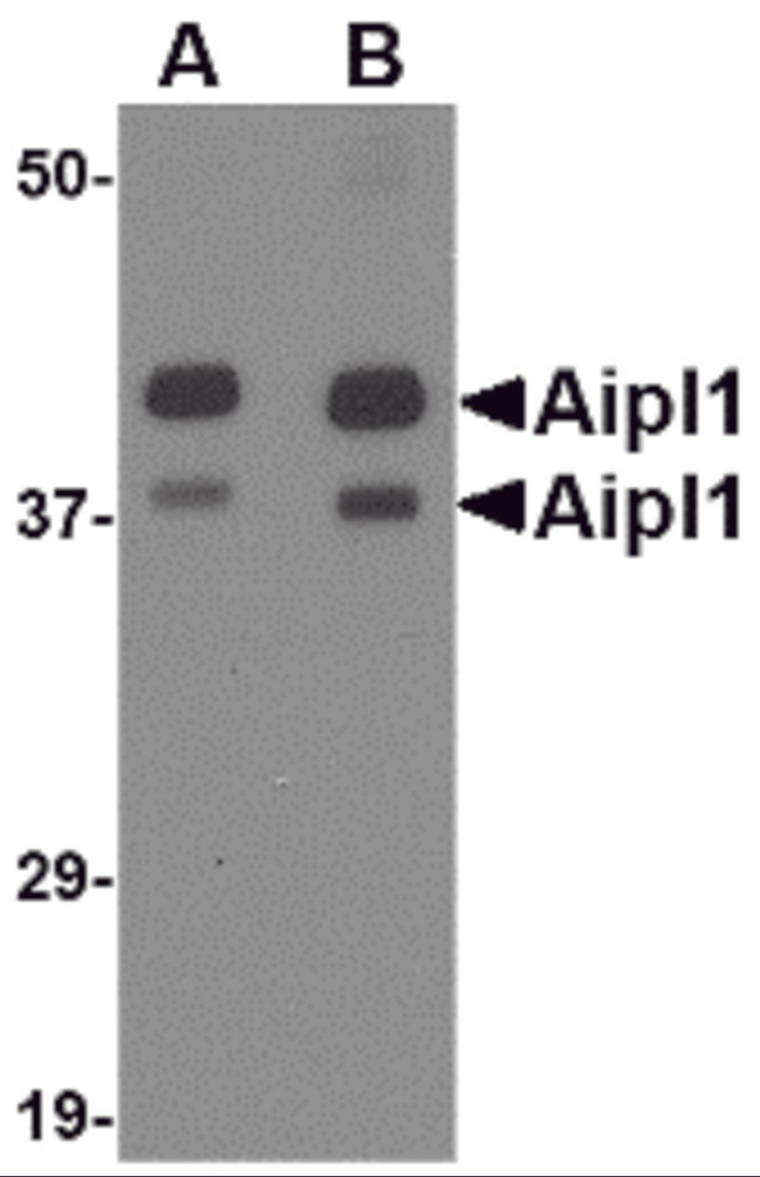Western blot analysis of Aipl1 in rat brain tissue lysate with Aipl1 antibody at (A) 1 and (B) 2 μg/mL.