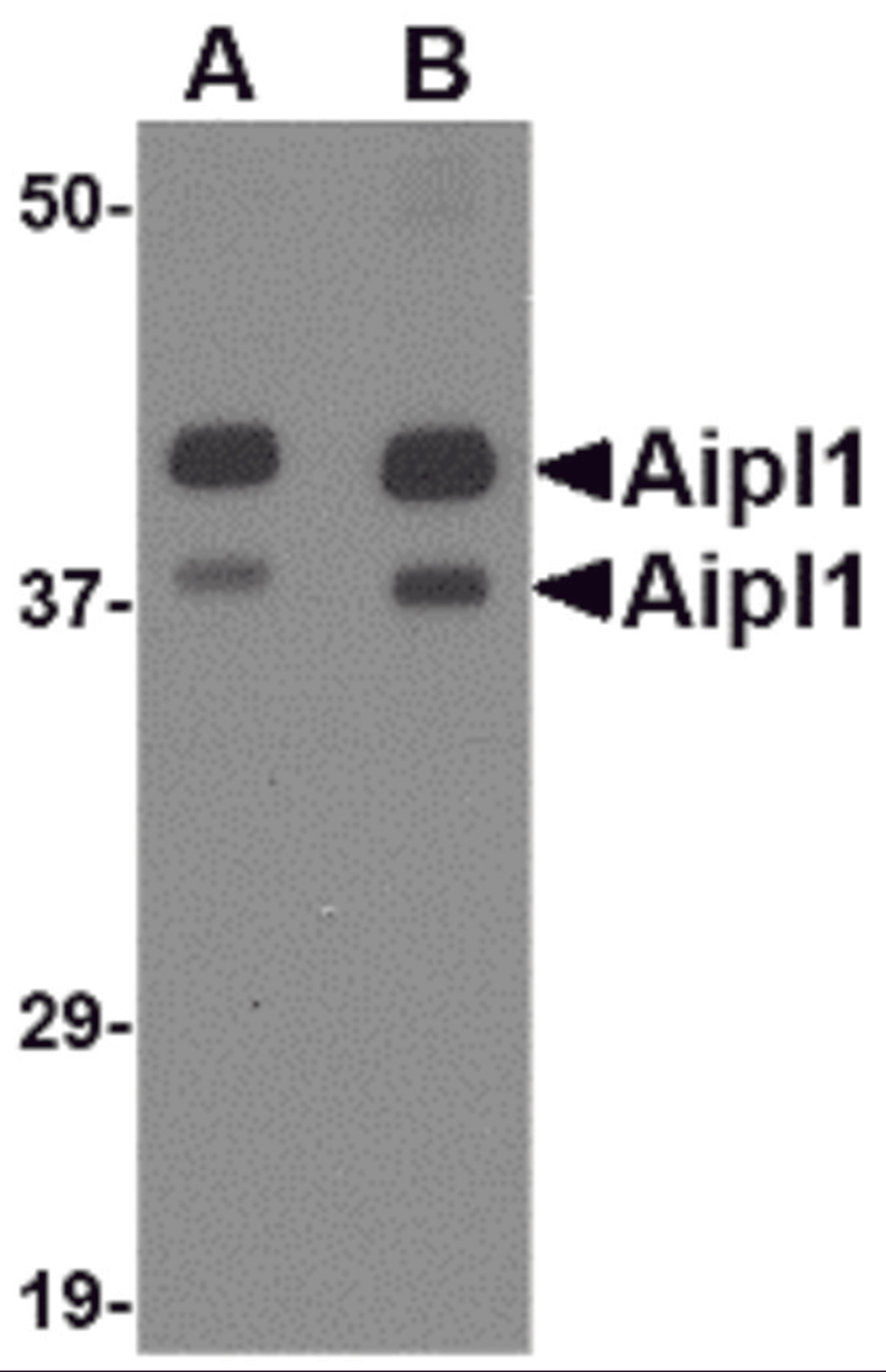 Western blot analysis of Aipl1 in rat brain tissue lysate with Aipl1 antibody at (A) 1 and (B) 2 μg/mL.