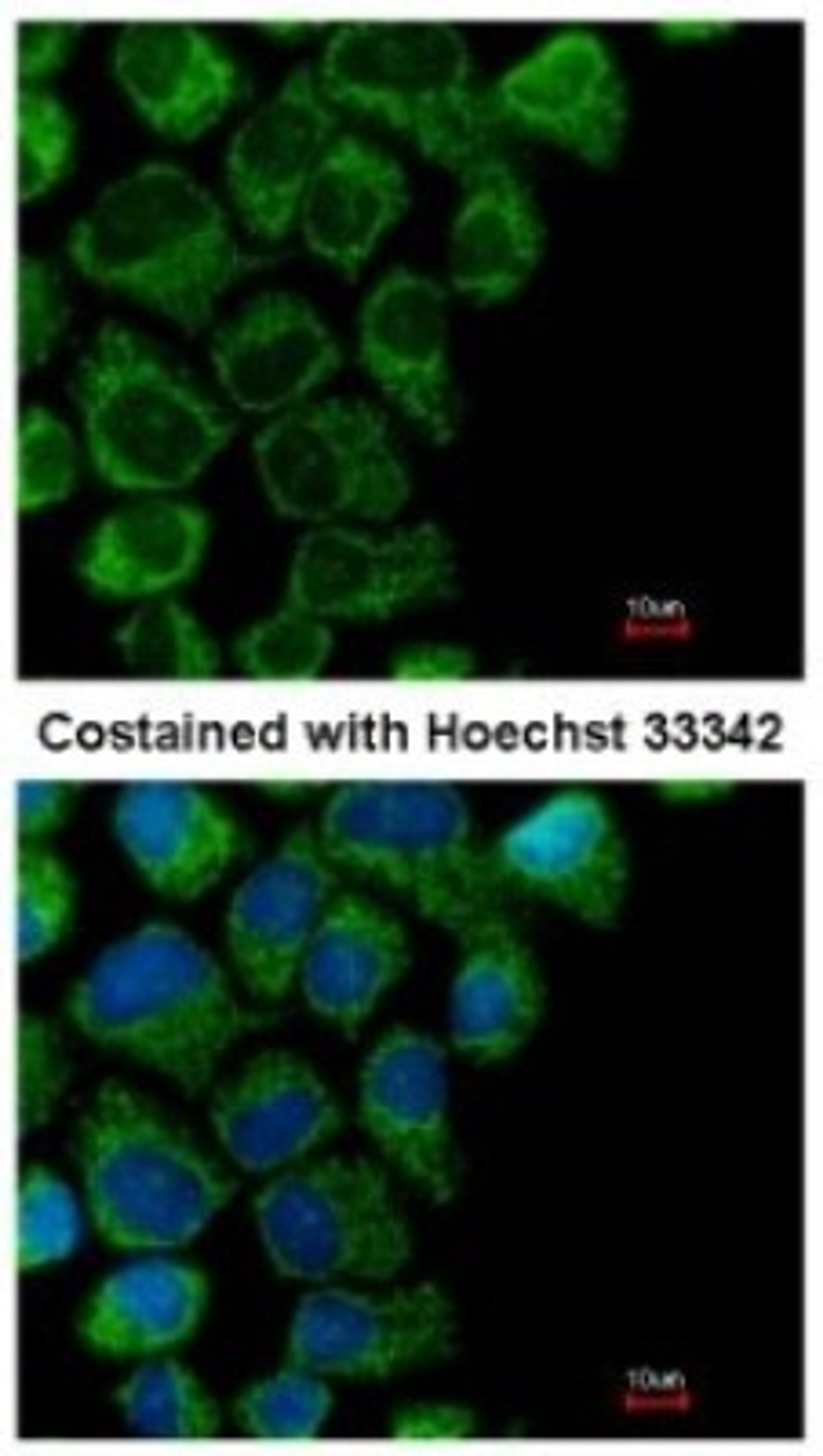 Immunocytochemistry/Immunofluorescence: OAT Antibody [NBP1-32390] - Analysis of methanol-fixed A431, using antibody at 1:200 dilution.