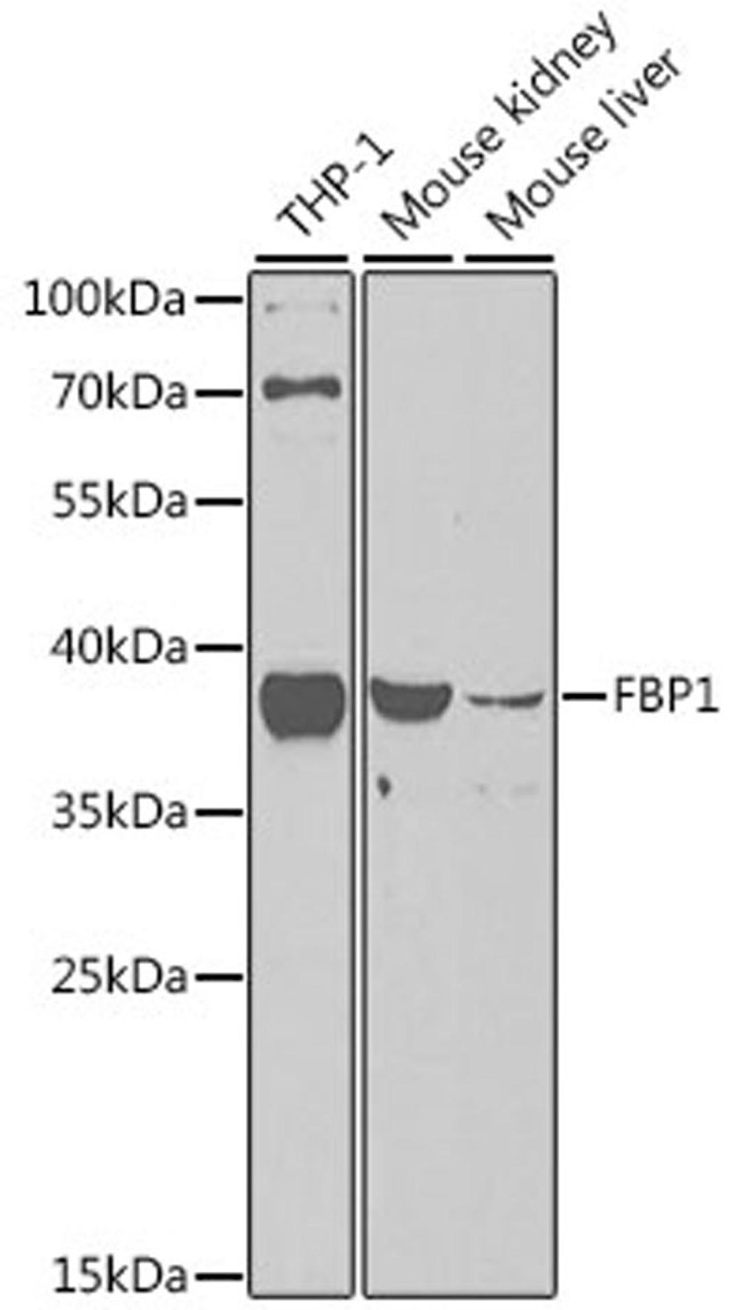 Western blot - FBP1 antibody (A5406)