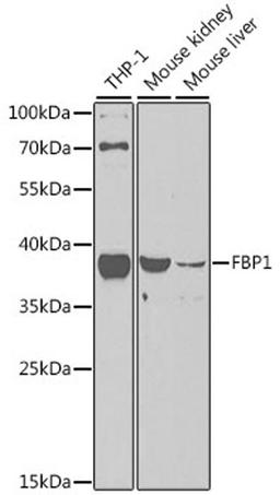 Western blot - FBP1 antibody (A5406)