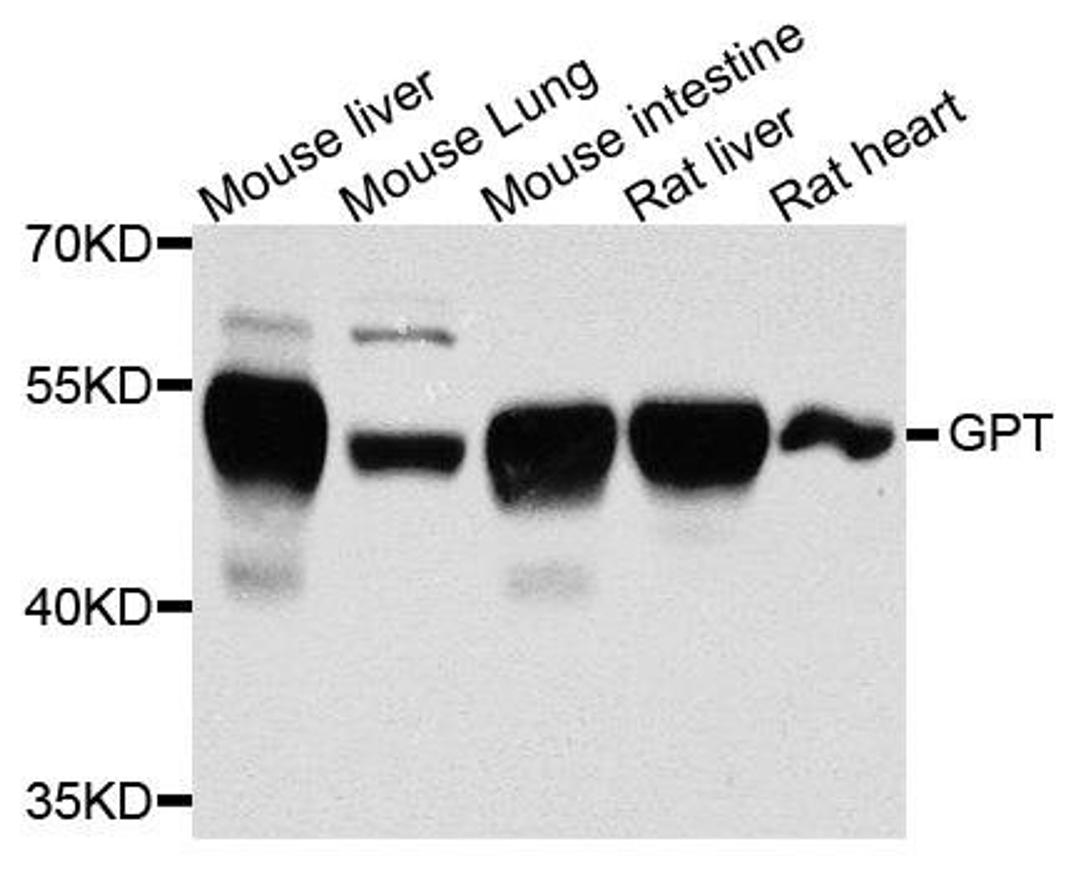 Western blot analysis of extracts of various cells using GPT antibody