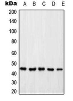 Western blot analysis of HeLa (Lane 1), Jurkat (Lane 2), HEK293T (Lane 3), SP2/0 (Lane 4), PC12 (Lane 5) whole cell lysates using PSMD6 antibody