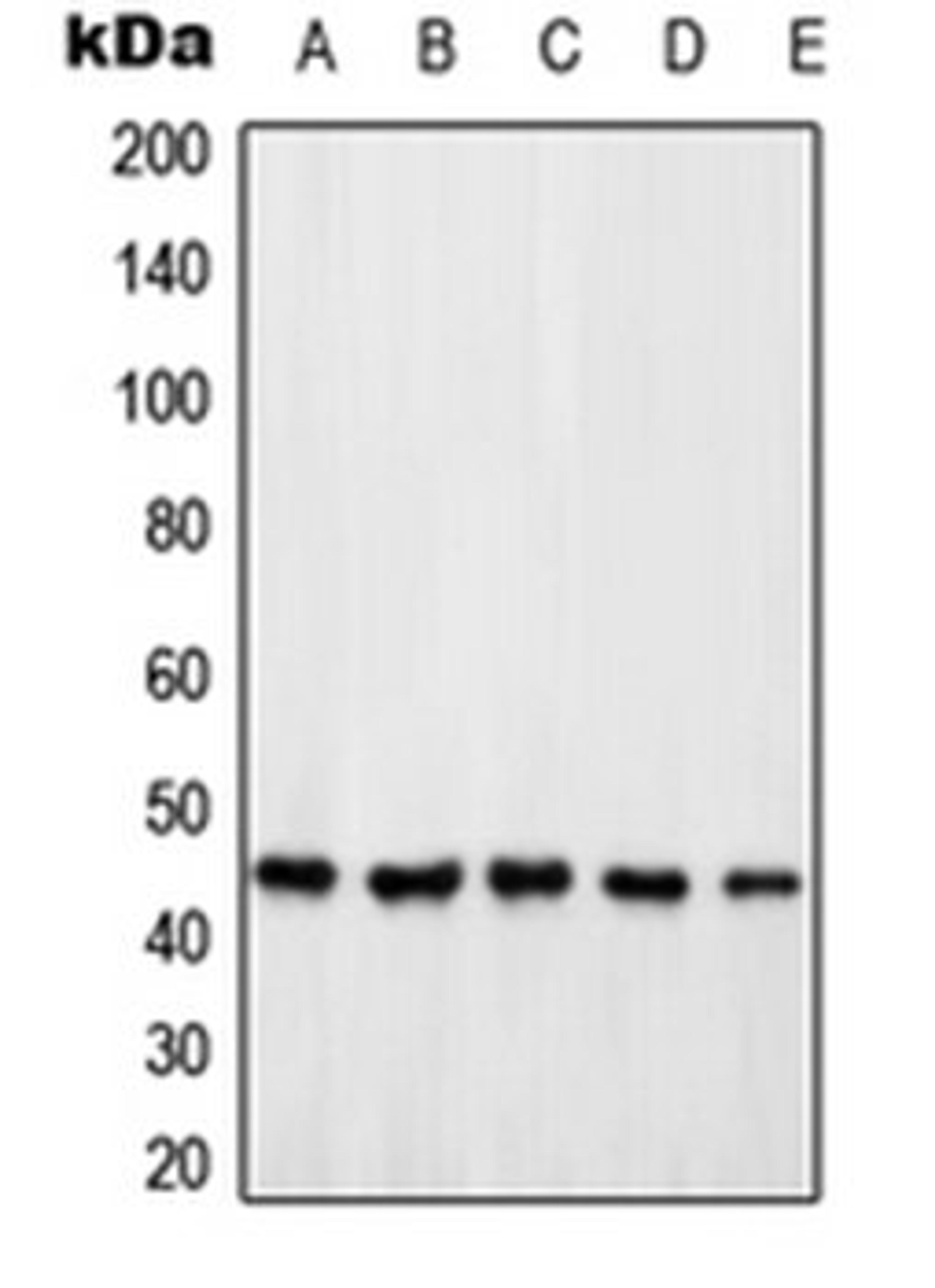 Western blot analysis of HeLa (Lane 1), Jurkat (Lane 2), HEK293T (Lane 3), SP2/0 (Lane 4), PC12 (Lane 5) whole cell lysates using PSMD6 antibody