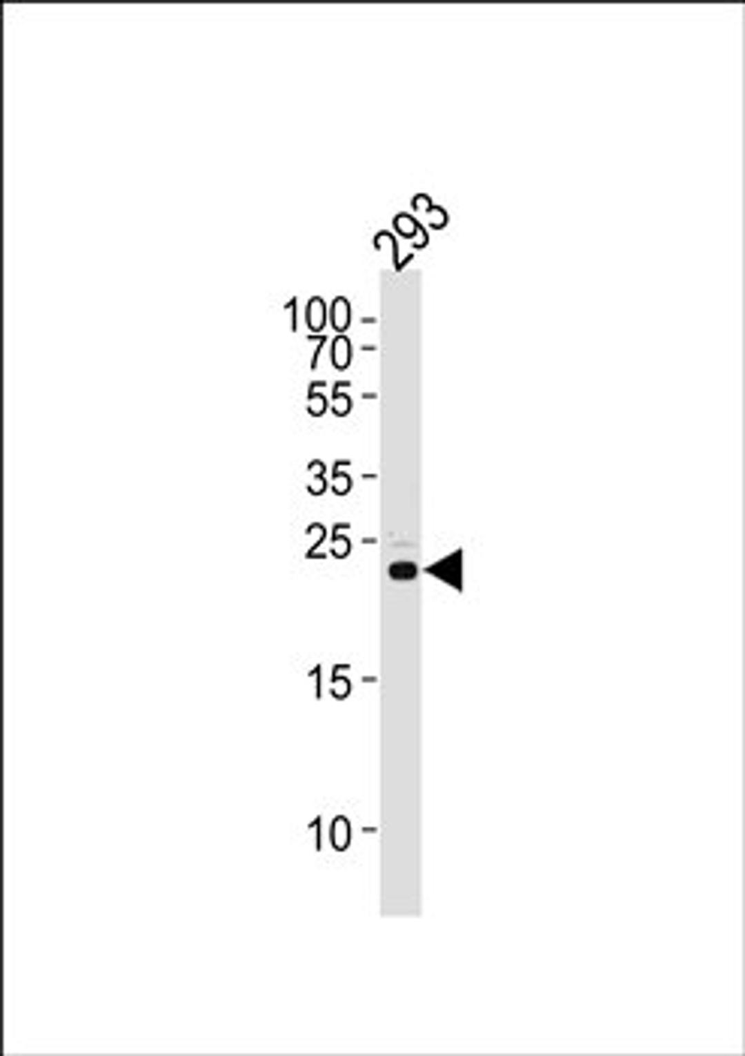 Western blot analysis of 293 cell line lysates (35ug/lane) using RSPO2 antibody