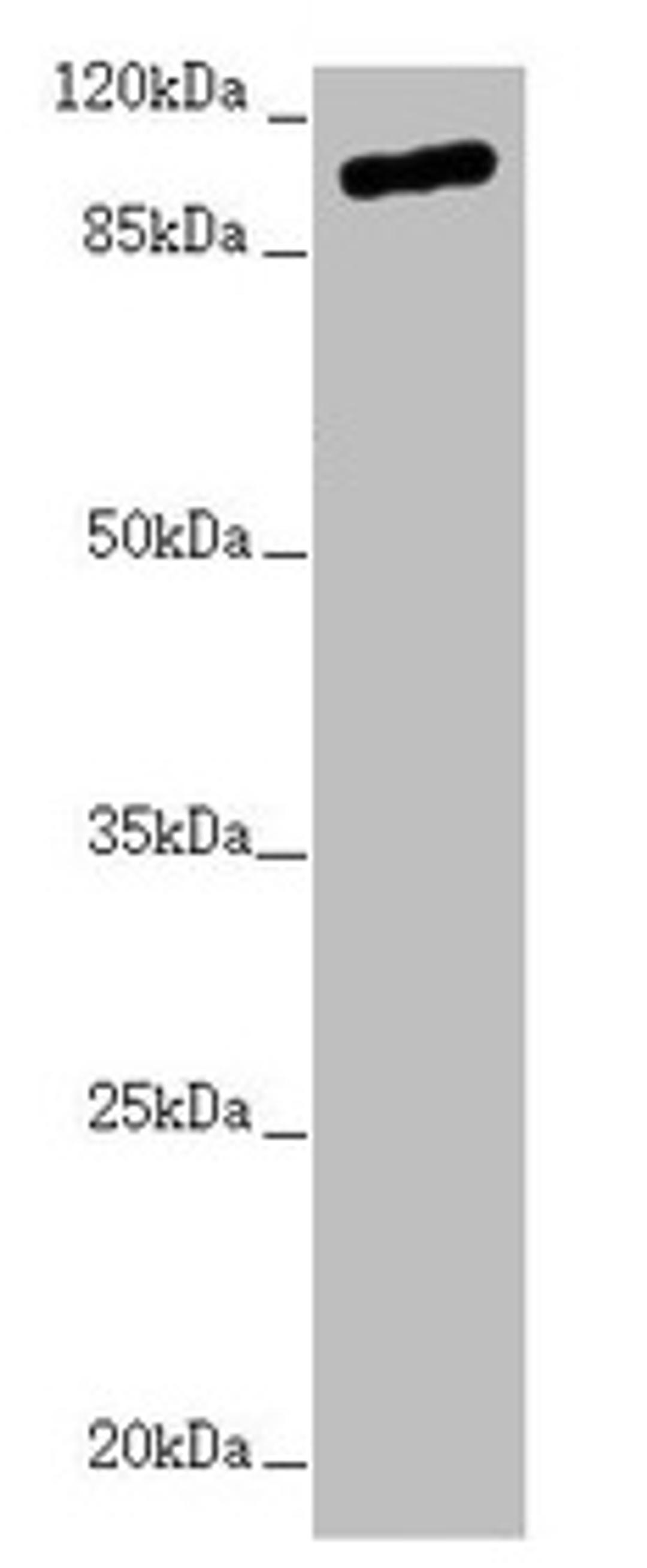Western blot. All lanes: TTLL7 antibody at 2.04µg/ml + Hela whole cell lysate. Secondary. Goat polyclonal to rabbit IgG at 1/10000 dilution. Predicted band size: 103, 78, 93 kDa. Observed band size: 103 kDa