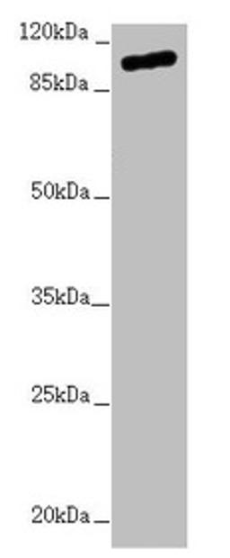 Western blot. All lanes: TTLL7 antibody at 2.04µg/ml + Hela whole cell lysate. Secondary. Goat polyclonal to rabbit IgG at 1/10000 dilution. Predicted band size: 103, 78, 93 kDa. Observed band size: 103 kDa