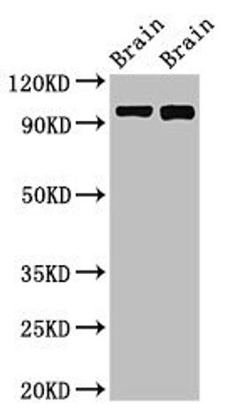 Western blot analysis of Rat brain tissue(lane 1), Mouse brain tissue(lane 2) using ATP6V0A1 antibody