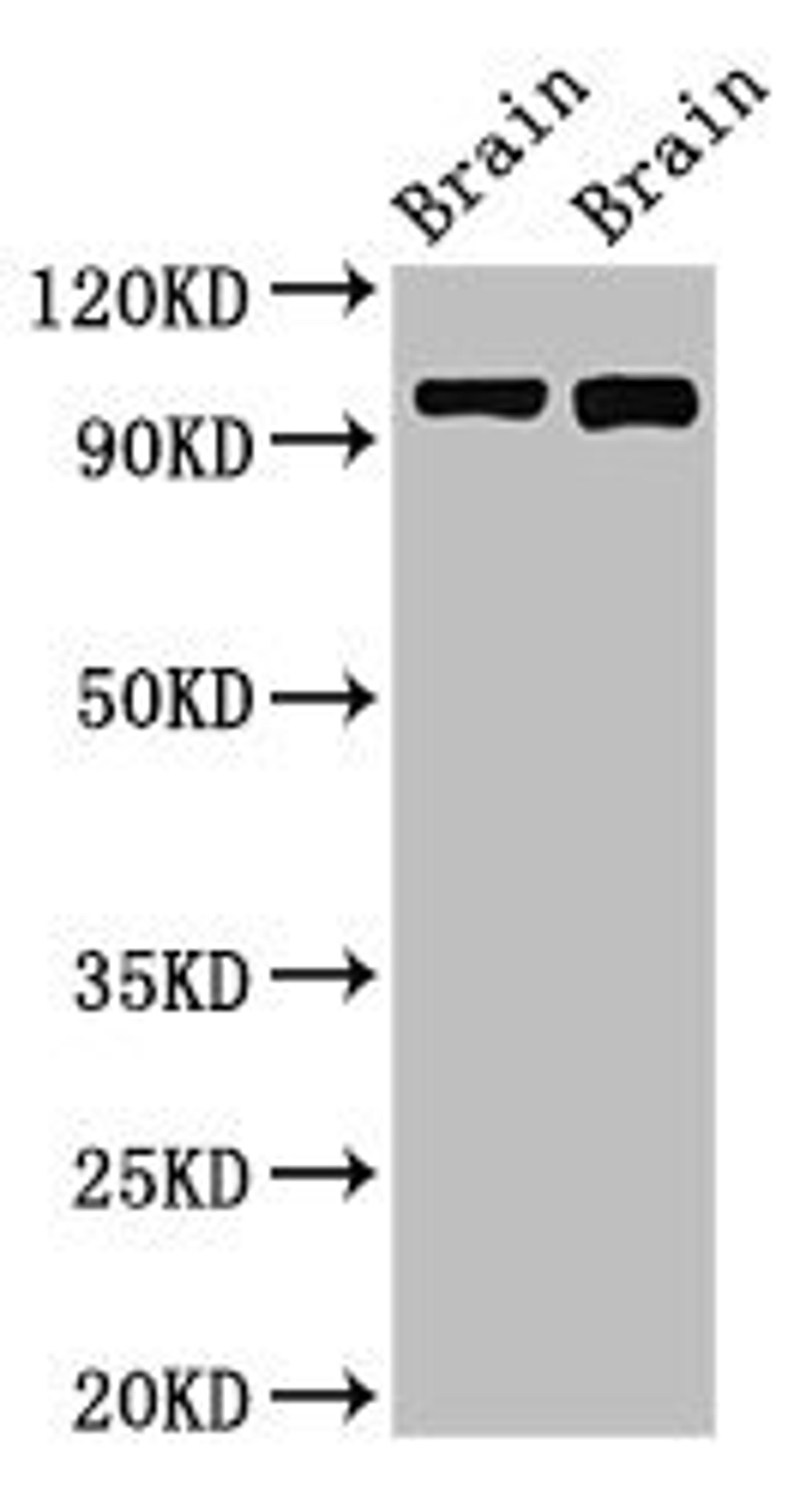 Western blot analysis of Rat brain tissue(lane 1), Mouse brain tissue(lane 2) using ATP6V0A1 antibody