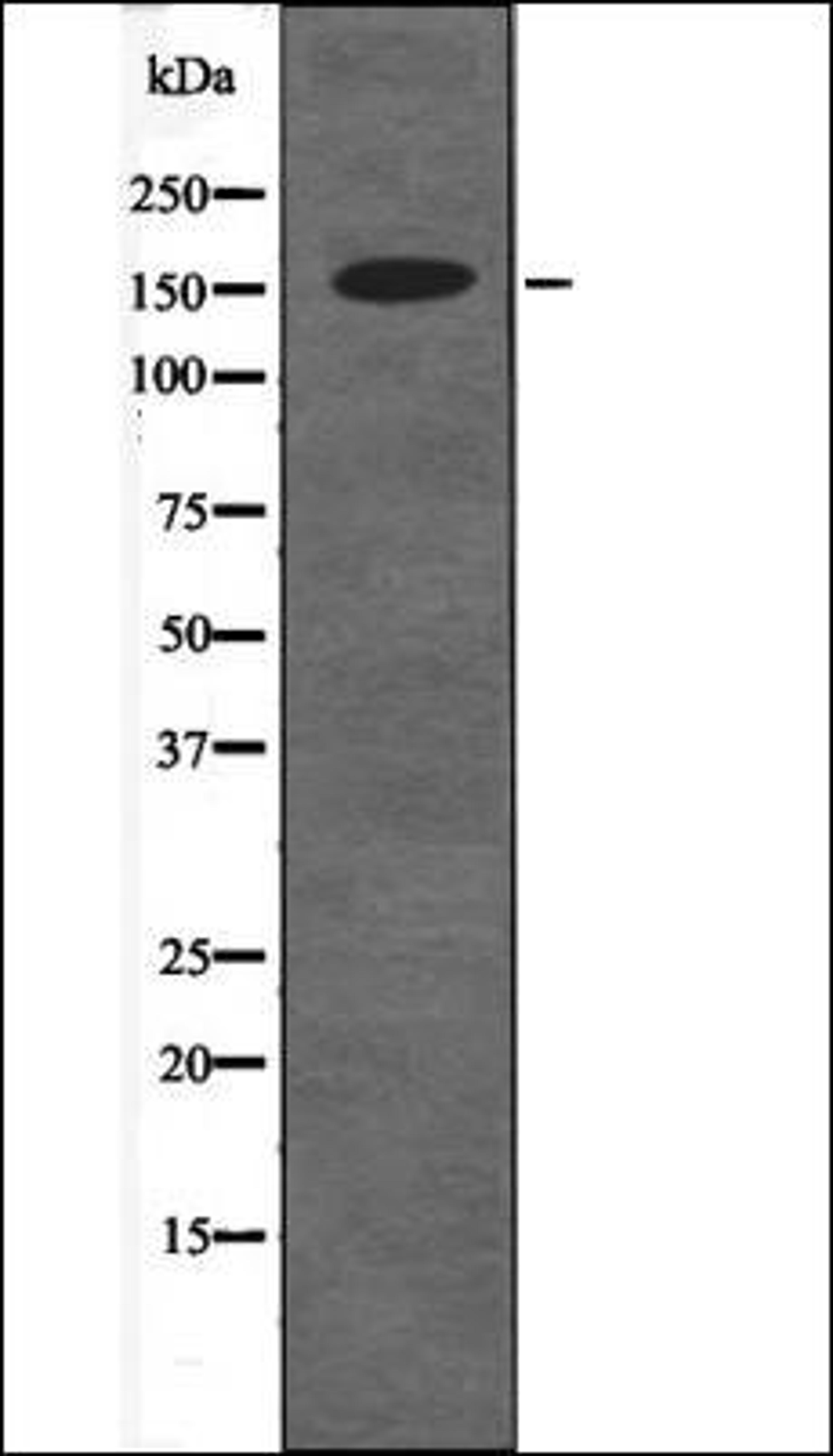 Western blot analysis of 293 whole cell lysates using RAD50 -Phospho-Ser635- antibody