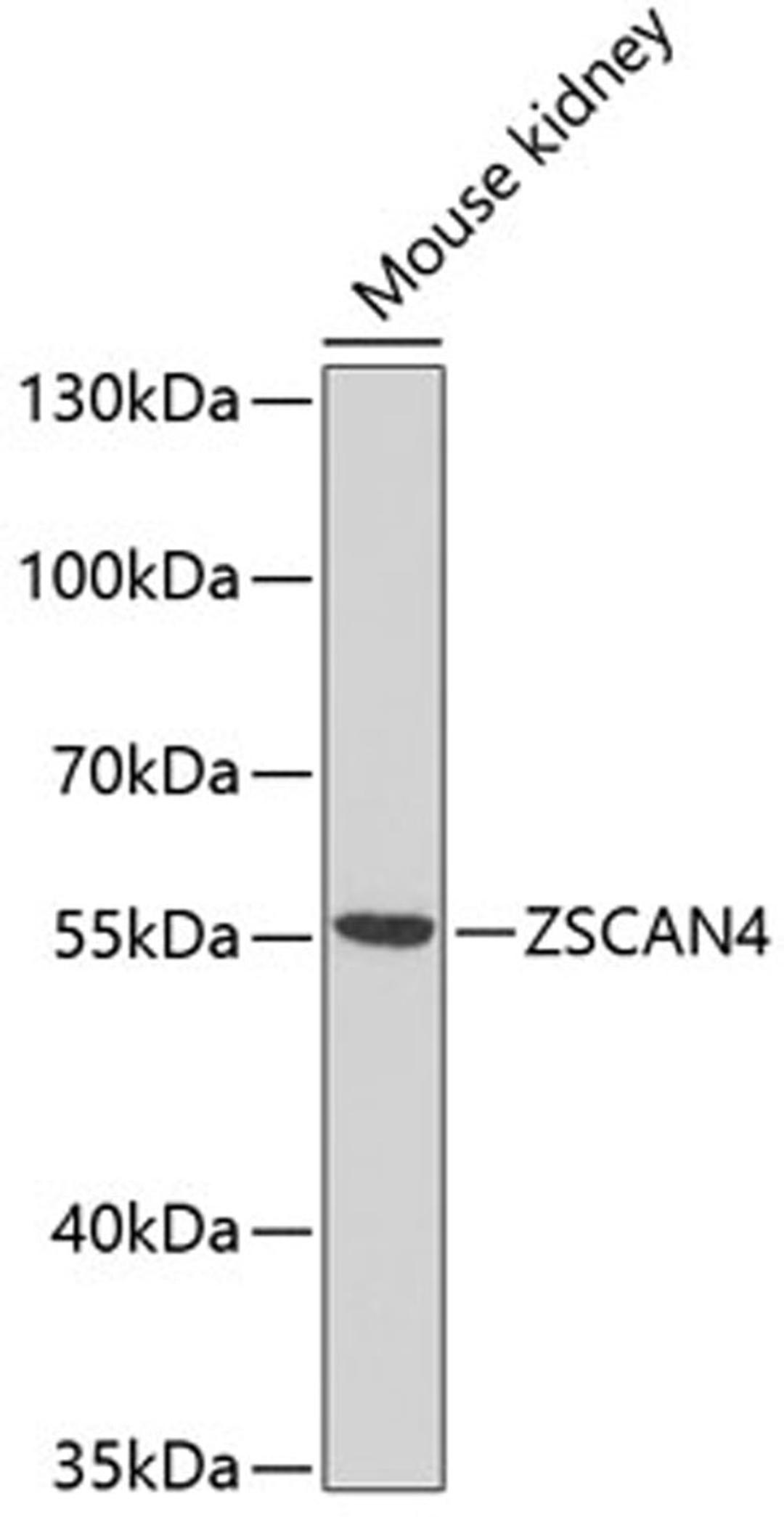 Western blot - ZSCAN4 antibody (A10205)