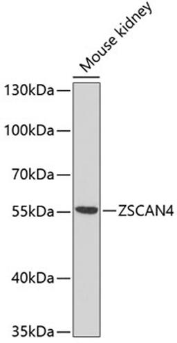 Western blot - ZSCAN4 antibody (A10205)