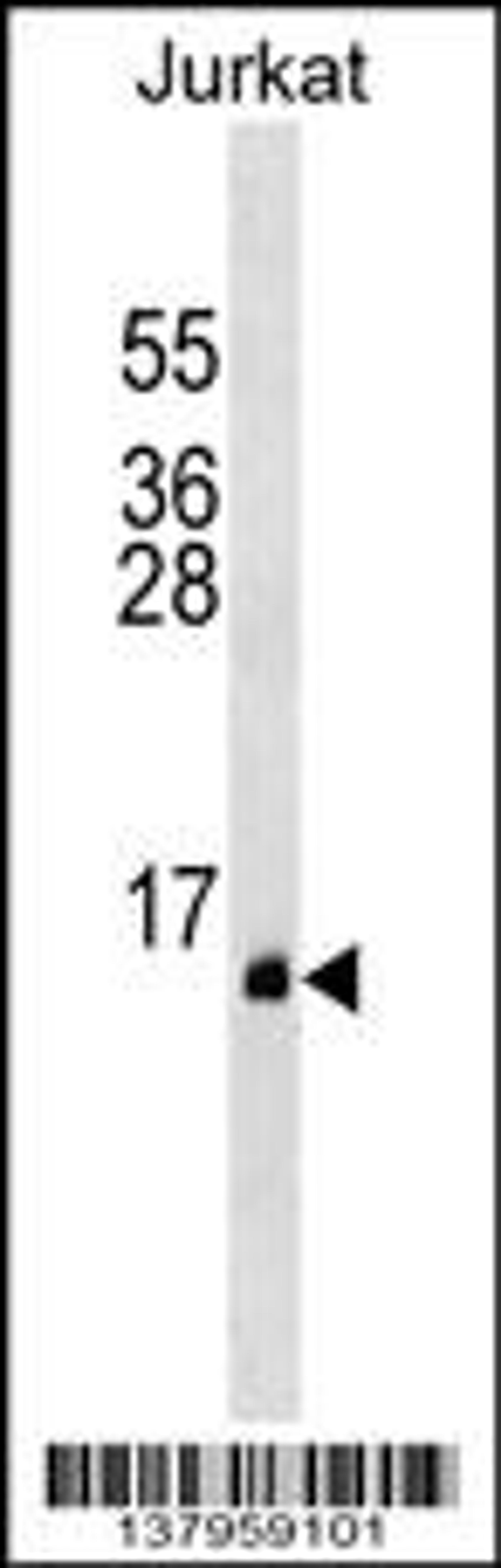 Western blot analysis in Jurkat cell line lysates (35ug/lane).