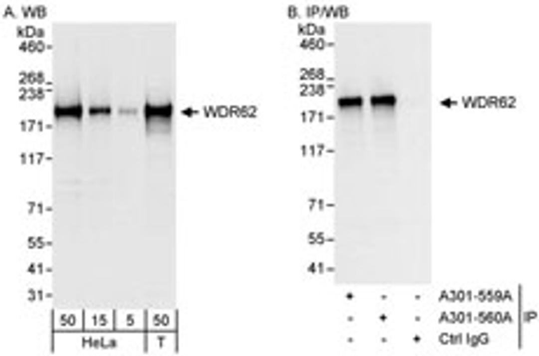 Detection of human WDR62 by western blot and immunoprecipitation.