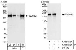 Detection of human WDR62 by western blot and immunoprecipitation.