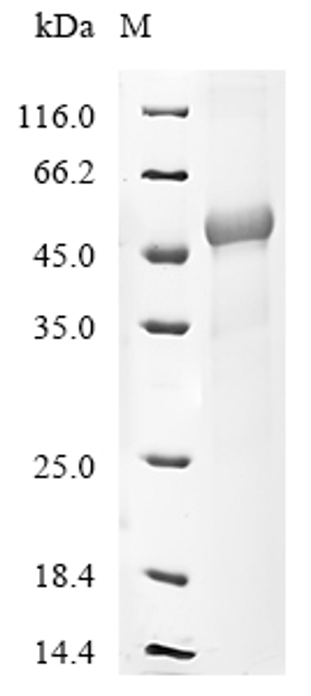 (Tris-Glycine gel) Discontinuous SDS-PAGE (reduced) with 5% enrichment gel and 15% separation gel.