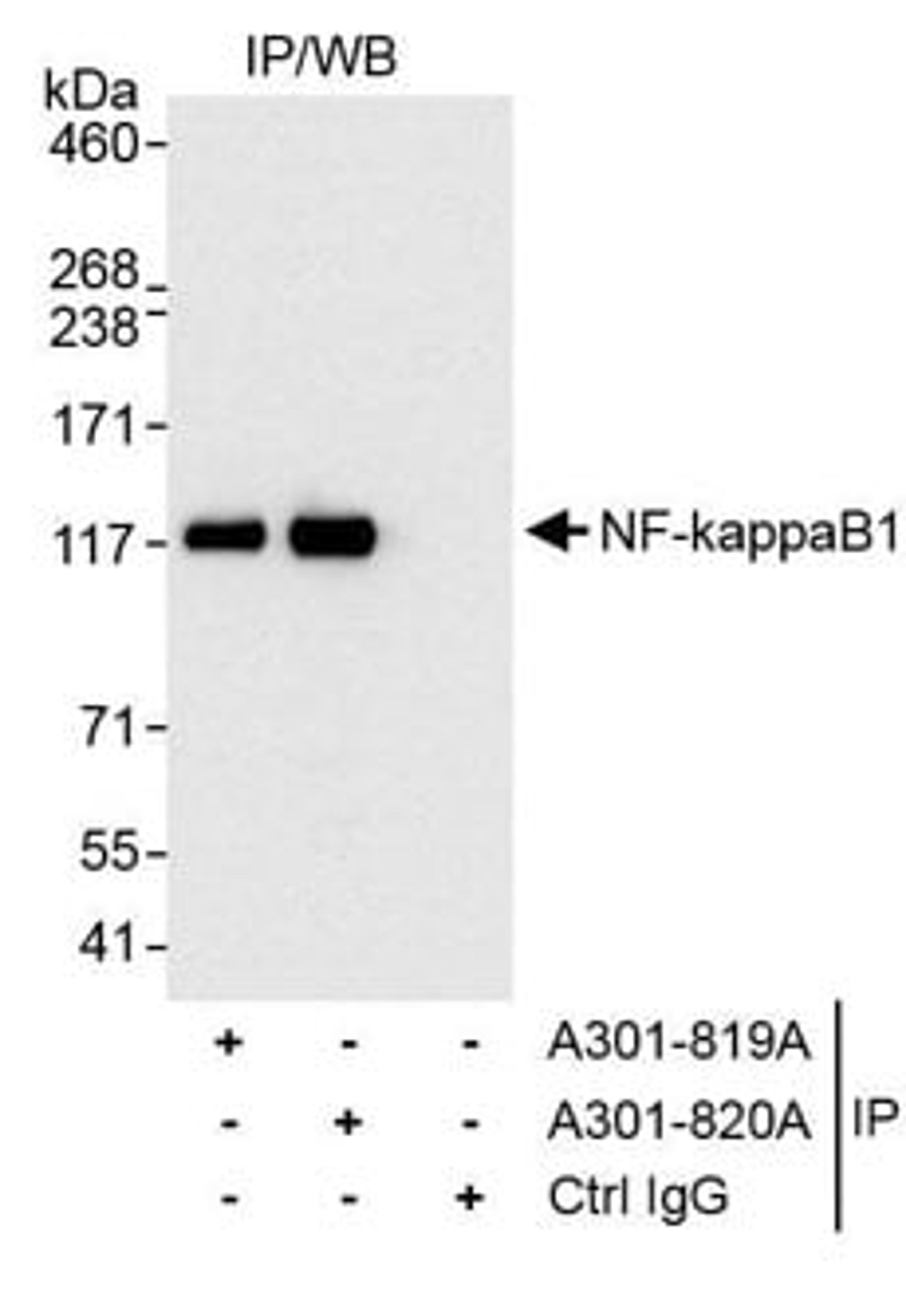 Detection of human NF-kappaB1 by western blot of immunoprecipitates.