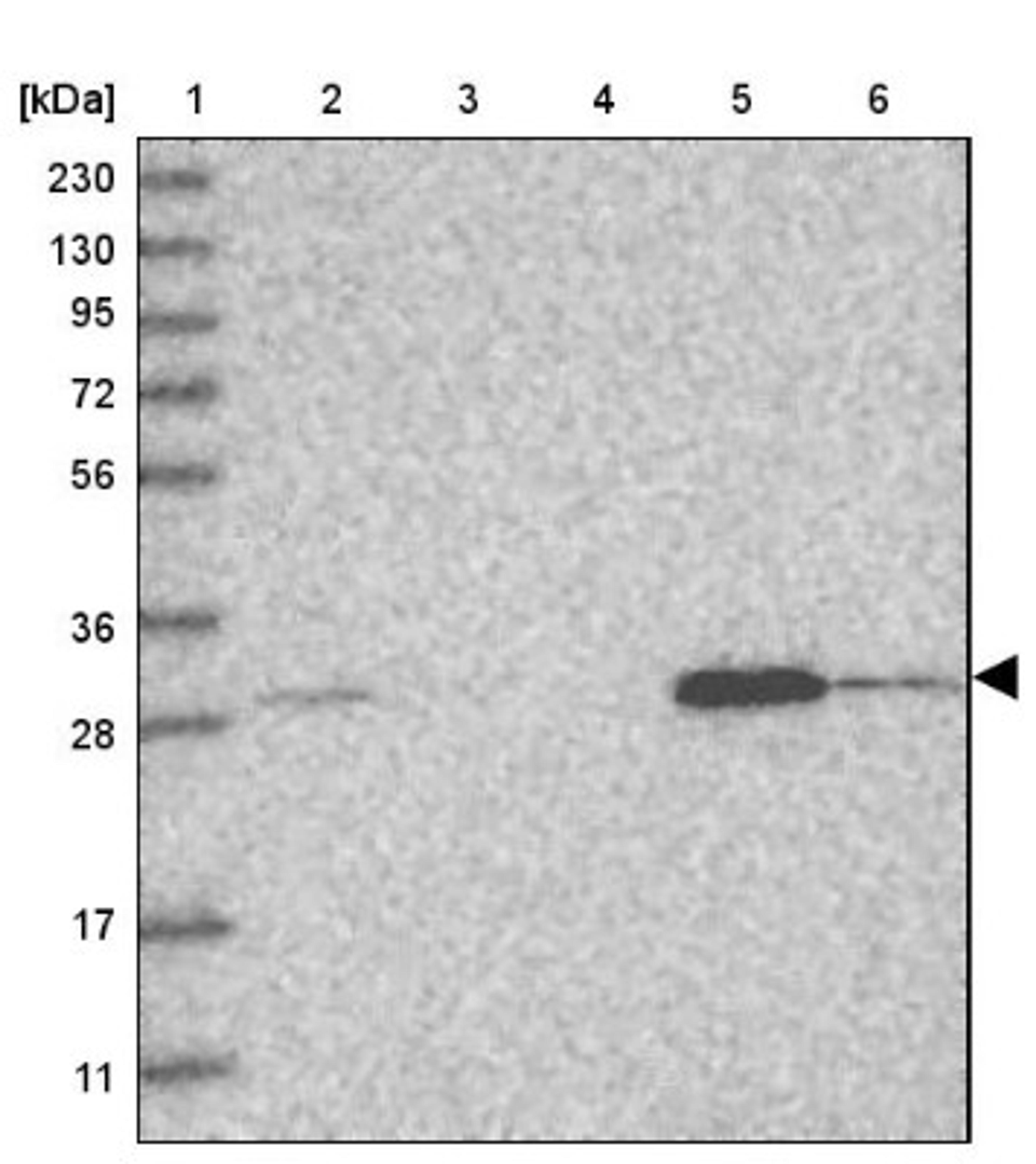 Western Blot: WDR33 Antibody [NBP1-83756] - Lane 1: Marker [kDa] 230, 130, 95, 72, 56, 36, 28, 17, 11<br/>Lane 2: Human cell line RT-4<br/>Lane 3: Human cell line U-251MG sp<br/>Lane 4: Human plasma (IgG/HSA depleted)<br/>Lane 5: Human liver tissue<br/>Lane 6: Human tonsil tissue