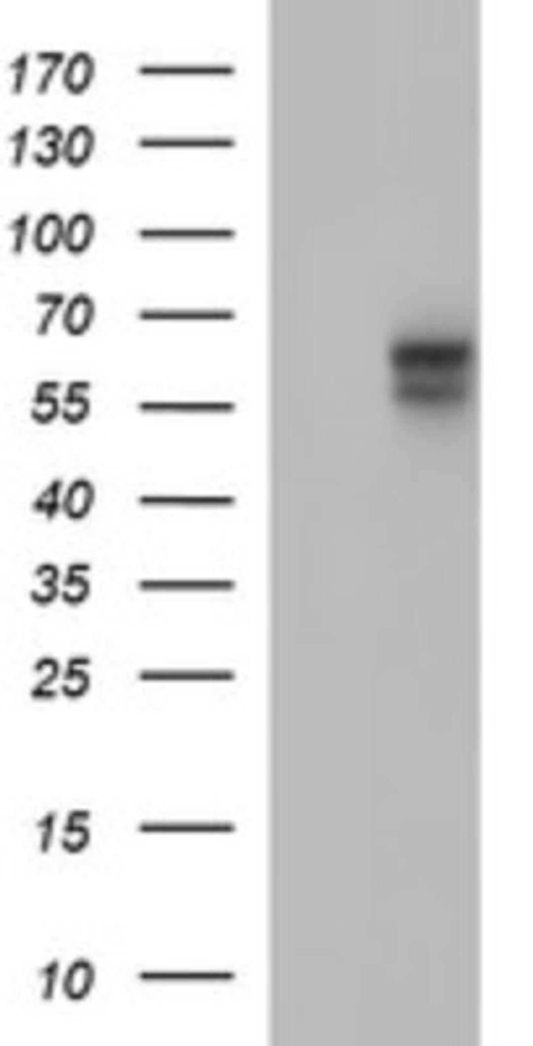 Western Blot: IL-10 R alpha Antibody (1D10) [NBP2-46049] - Analysis of HEK293T cells were transfected with the pCMV6-ENTRY control (Left lane) or pCMV6-ENTRY IL-10 R alpha.