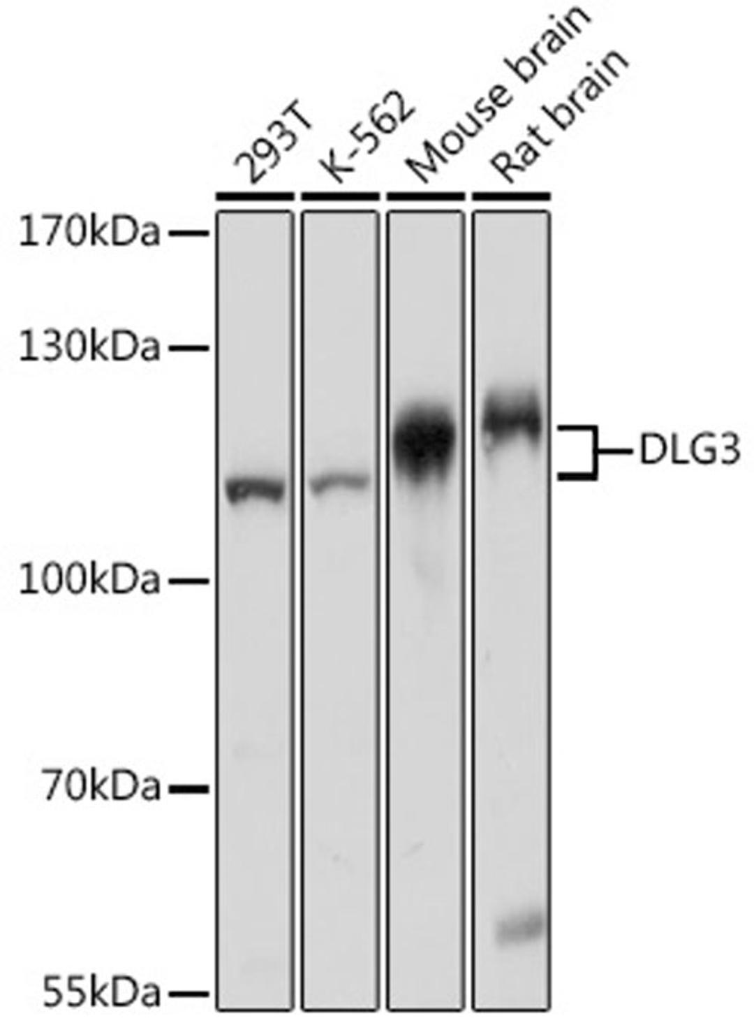 Western blot - DLG3 pAb (A16831)