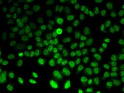 Immunofluorescence - ASMT antibody (A6529)