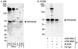 Detection of human PPP2R3B by western blot and immunoprecipitation.