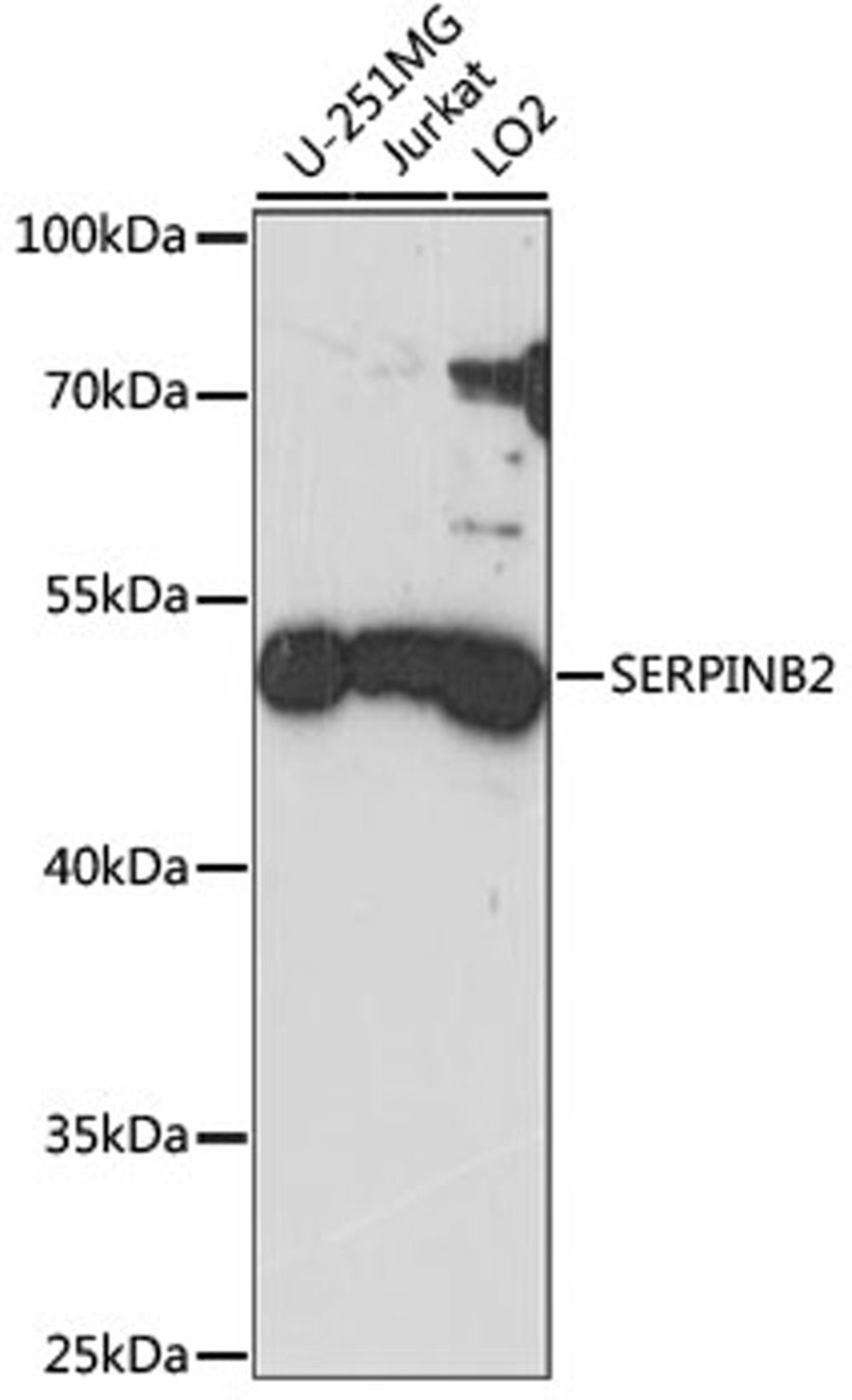 Western blot - SERPINB2 antibody (A15297)