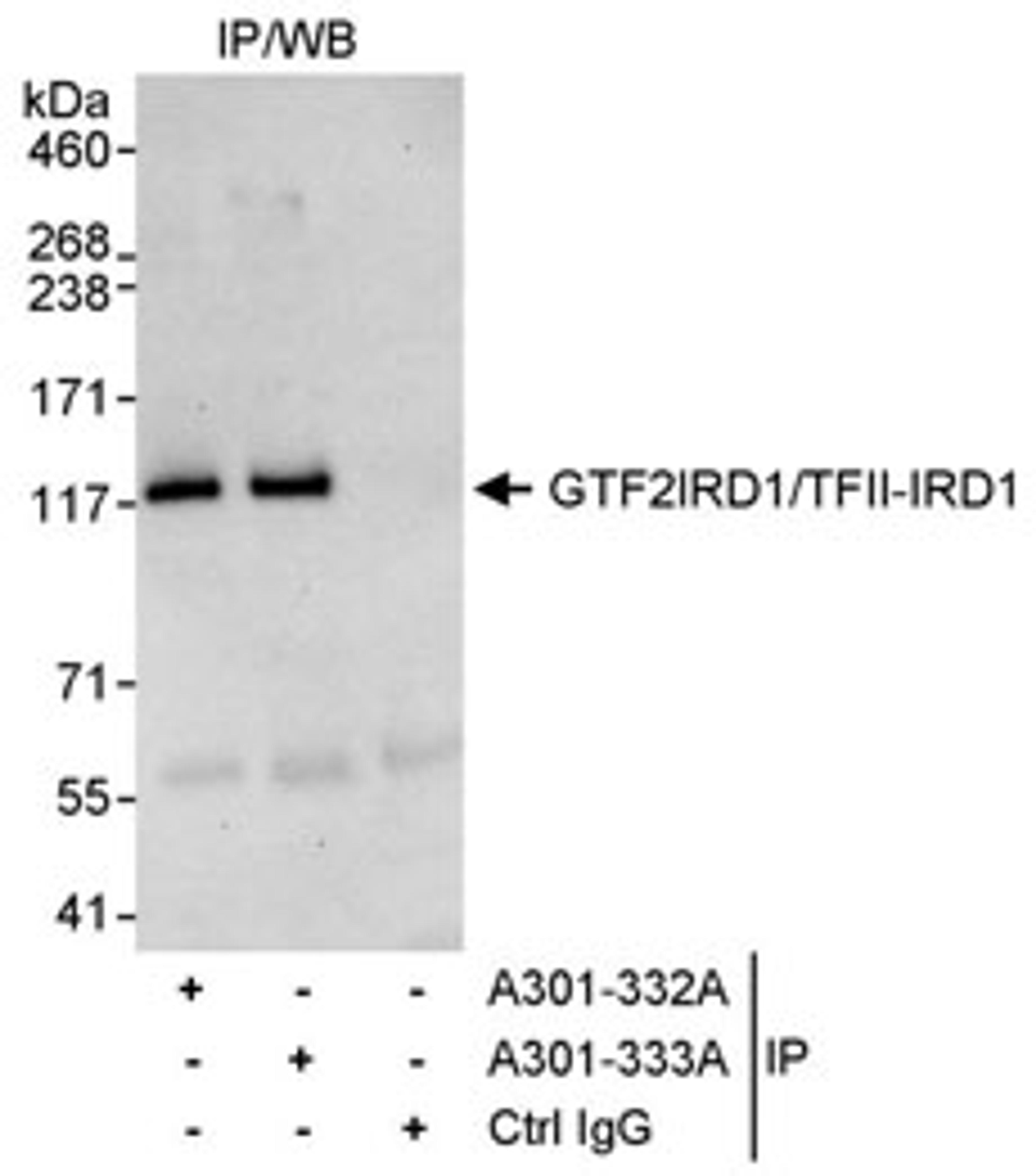 Detection of human GTF2IRD1/TFII-IRD1 by western blot of immunoprecipitates.