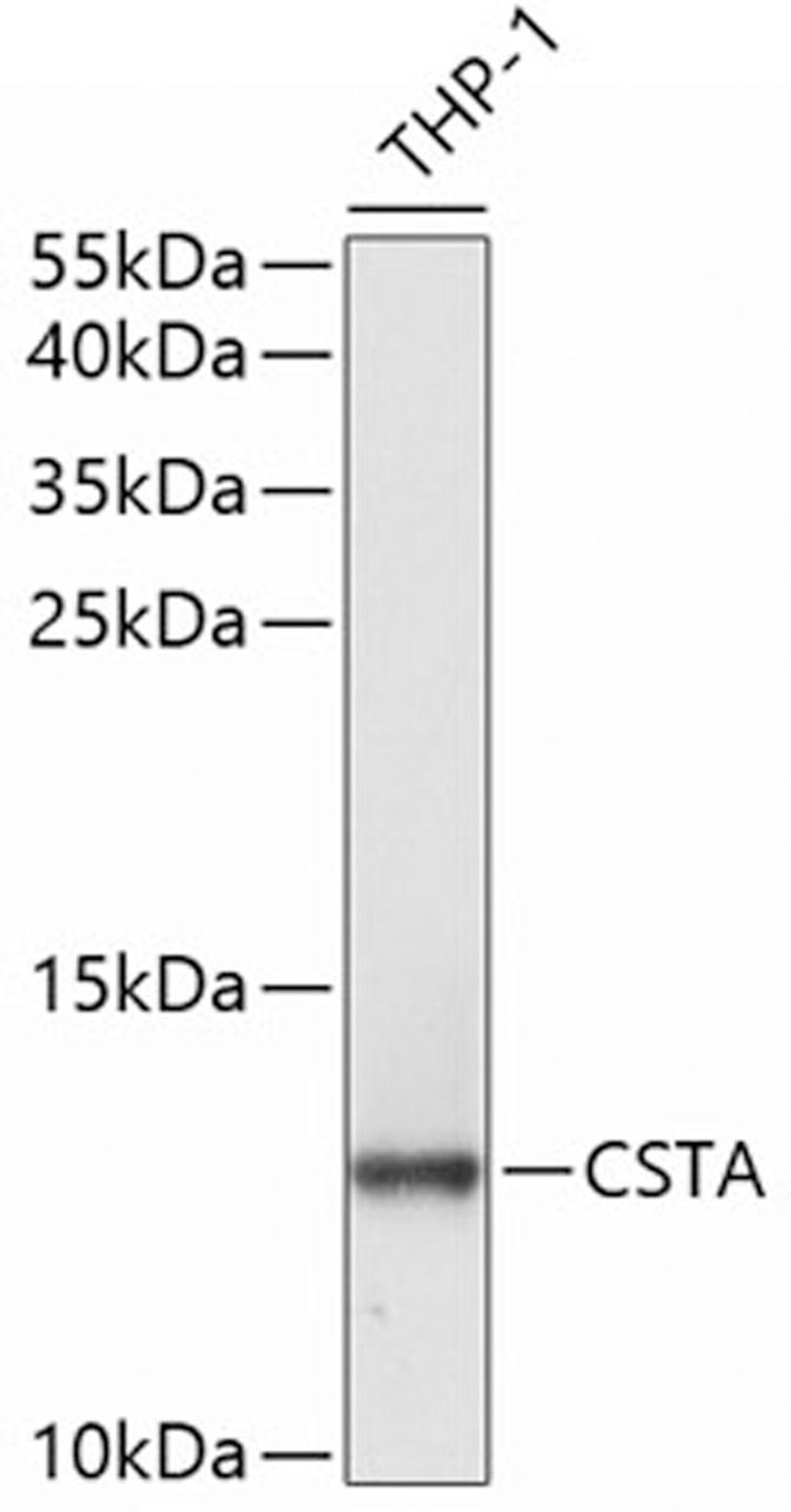 Western blot - CSTA antibody (A5686)