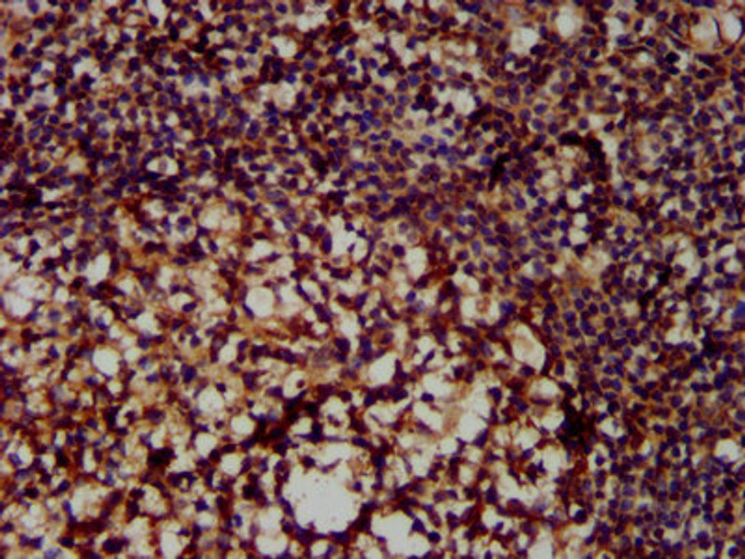 IHC image of CSB-PA015250LA01HU diluted at 1:300 and staining in paraffin-embedded human tonsil tissue performed on a Leica BondTM system. After dewaxing and hydration, antigen retrieval was mediated by high pressure in a citrate buffer (pH 6.0). Section was blocked with 10% normal goat serum 30min at RT. Then primary antibody (1% BSA) was incubated at 4&deg;C overnight. The primary is detected by a biotinylated secondary antibody and visualized using an HRP conjugated SP system.