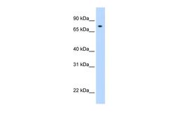 Antibody used in WB on recombinant STAT1 at 0.2-1 ug/ml.