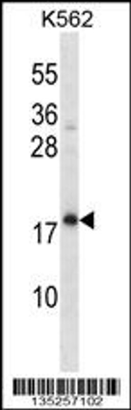 Western blot analysis in K562 cell line lysates (35ug/lane).