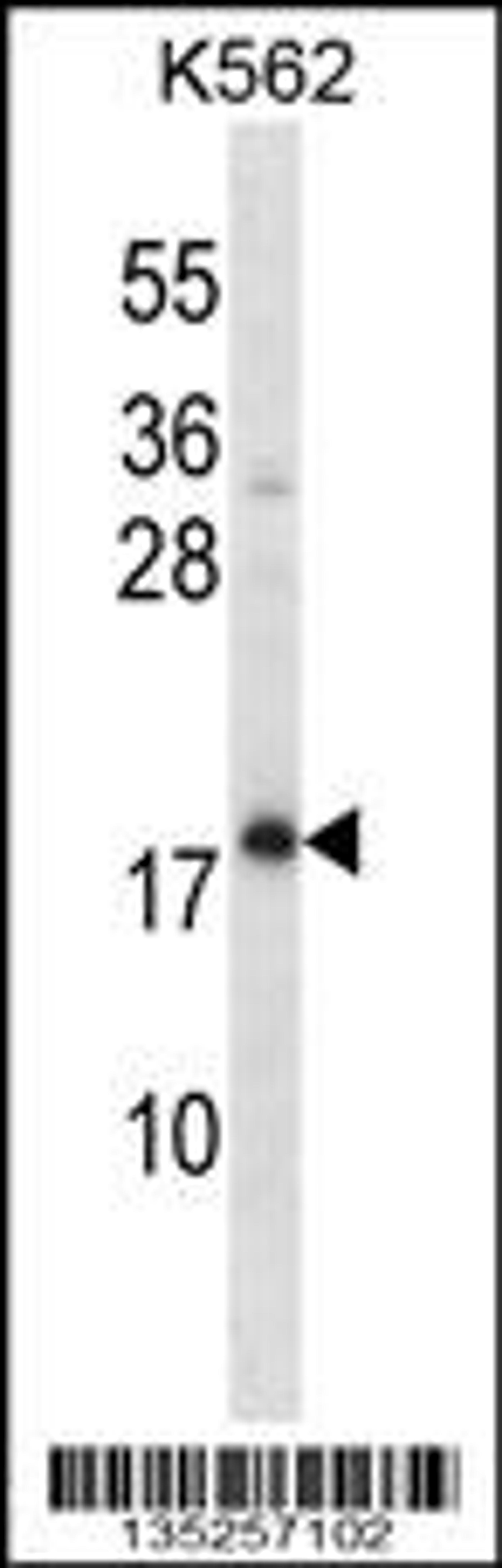 Western blot analysis in K562 cell line lysates (35ug/lane).