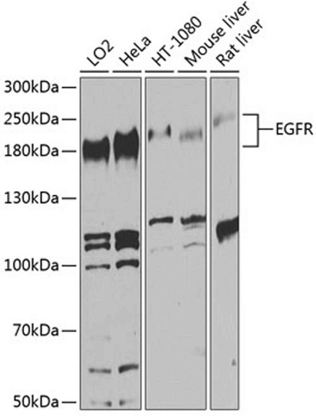 Western blot - EGFR antibody (A11575)