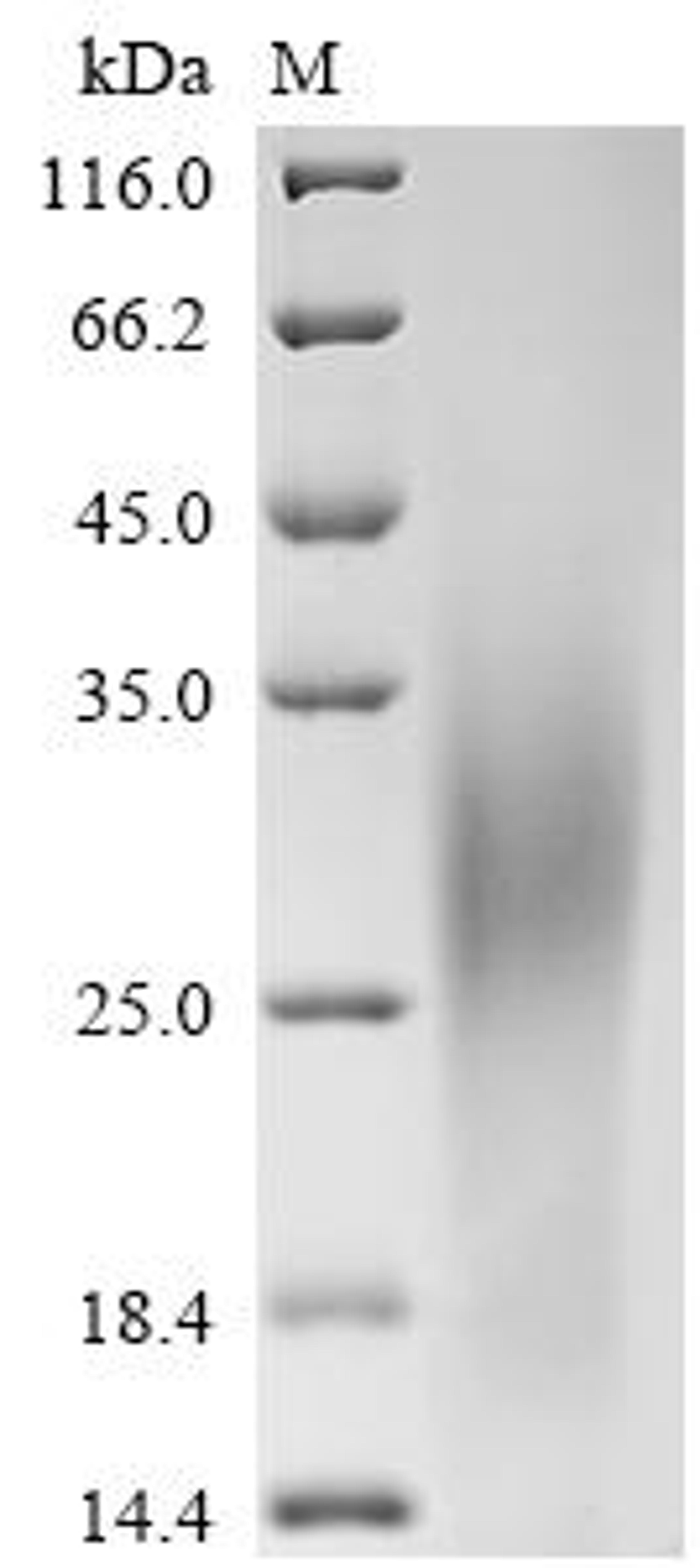 (Tris-Glycine gel) Discontinuous SDS-PAGE (reduced) with 5% enrichment gel and 15% separation gel.