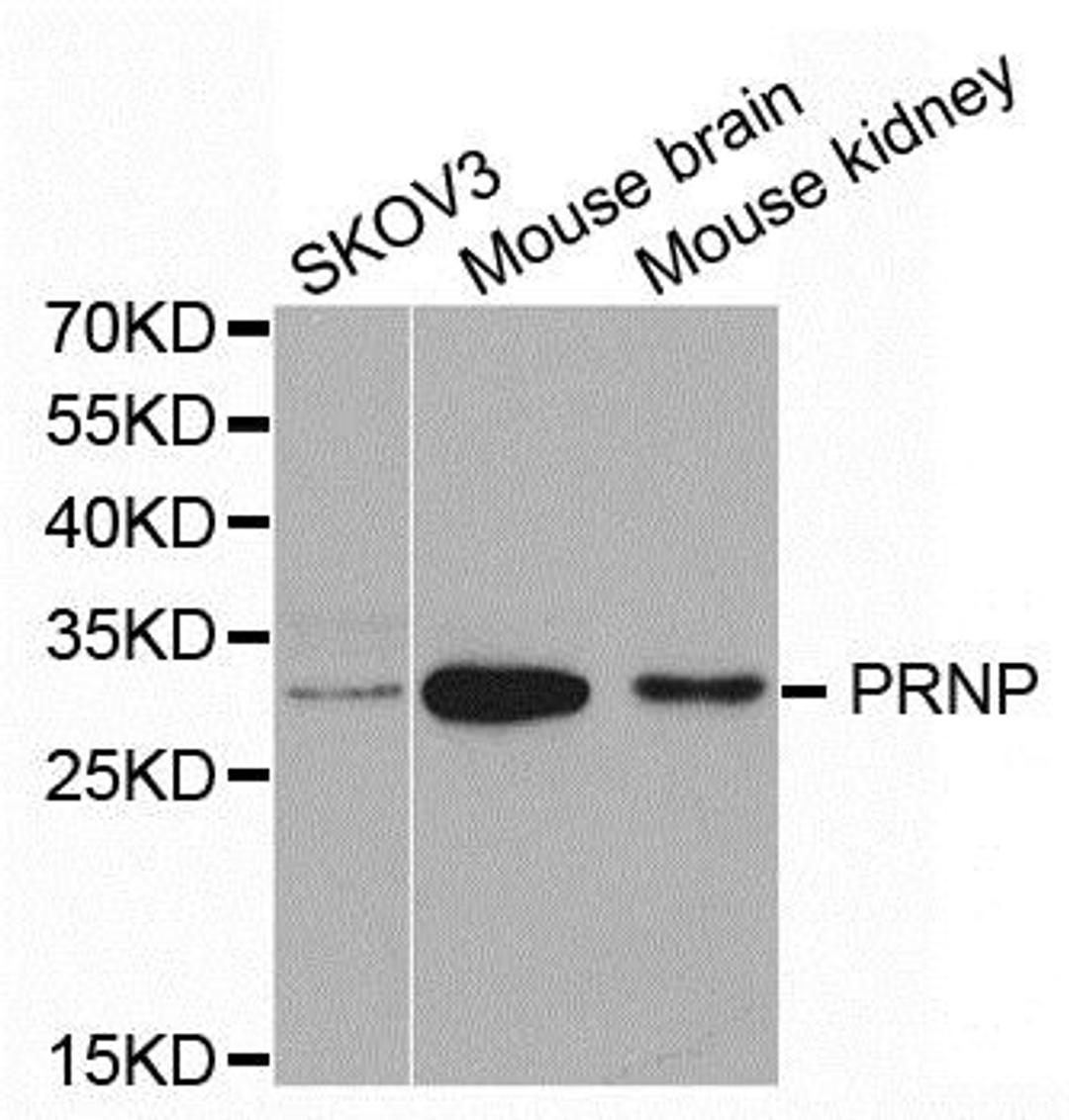 Western blot analysis of extracts of various cell lines using PRNP antibody